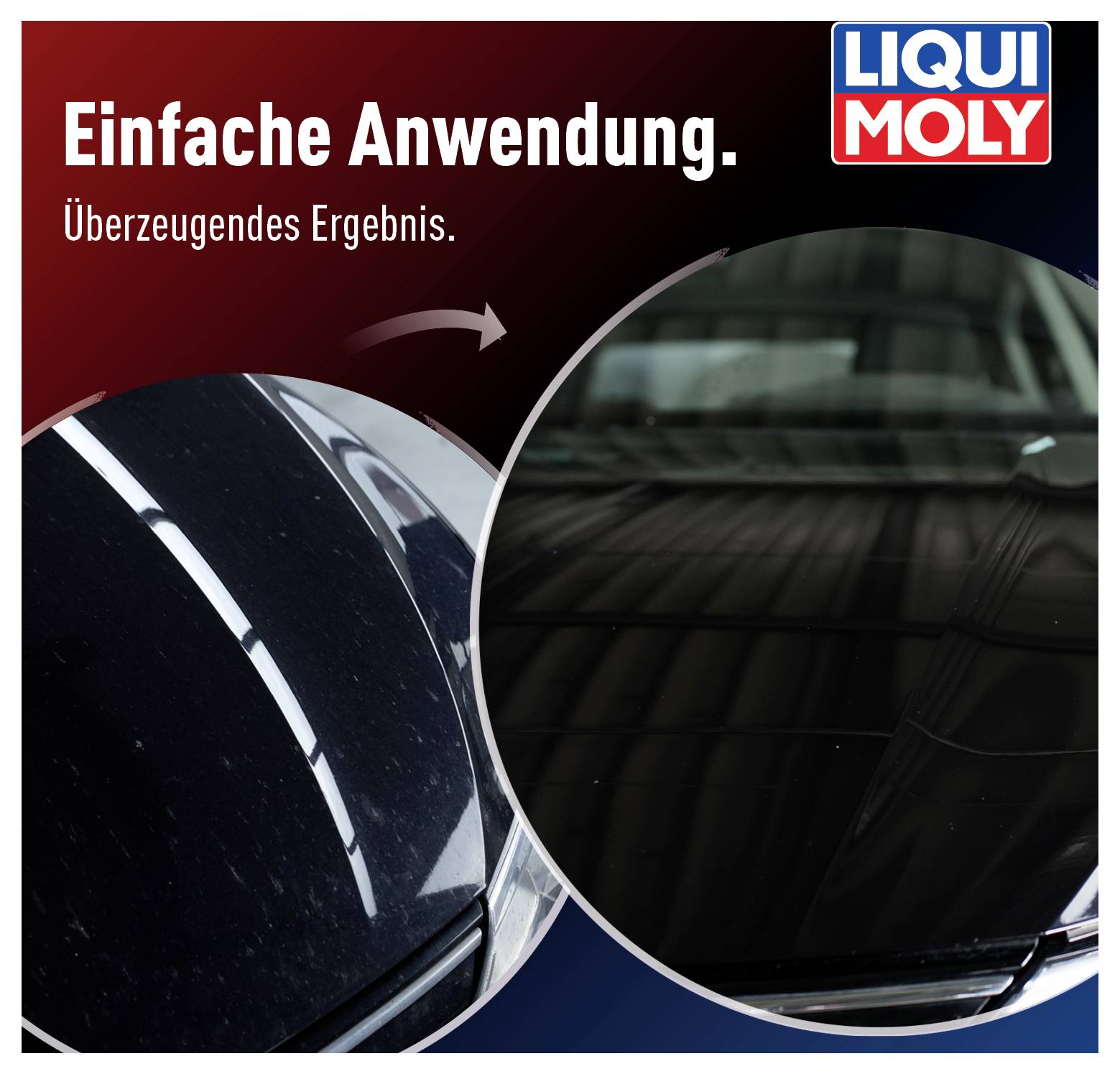 Liqui Moly 1548 Insektenschwamm 1St.