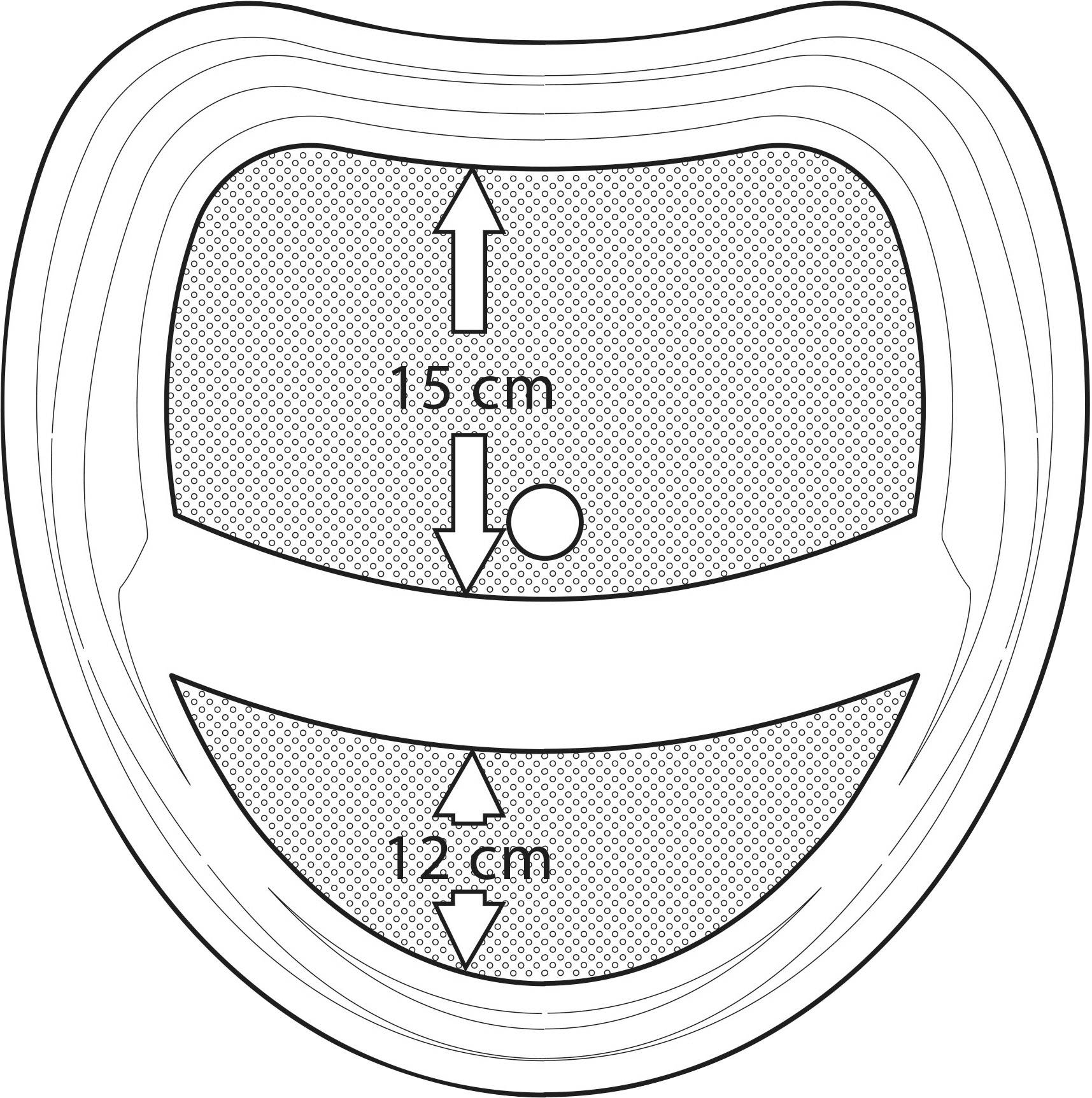 BIG-Baby-Step Tritterhöhung