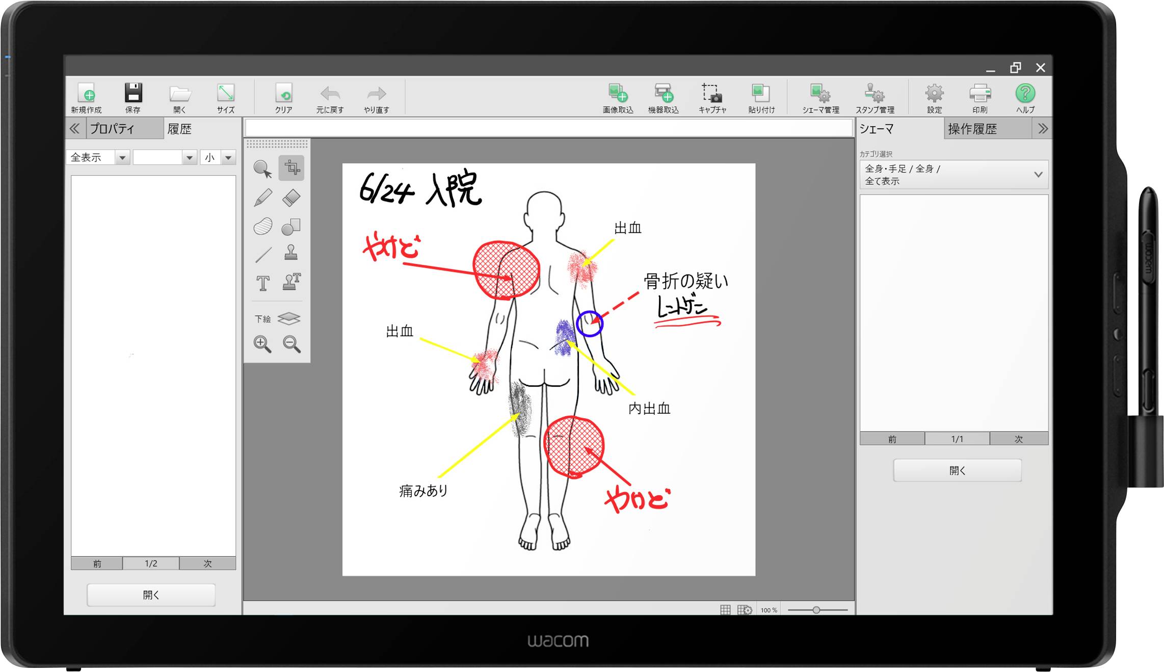 Wacom DTH-2452 Kabelgebunden Kreativ-Stifttablett EEK: E (A - G) Schwarz
