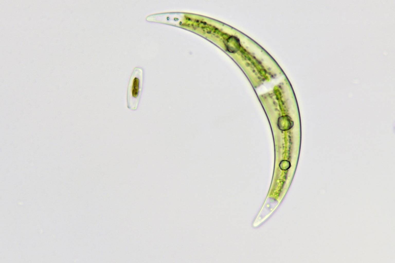 Mikroskopische Ansicht einer sichelförmigen Grünalge auf einem weißen Hintergrund. Zwei weitere kleine Algen sind sichtbar.