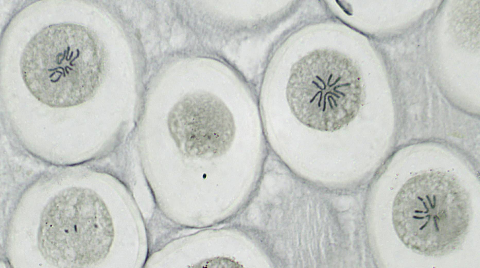 Mikroskopische Aufnahme von Zellen in der Zellteilung. Einige Zellen zeigen Chromosomenanordnung während der Mitose.