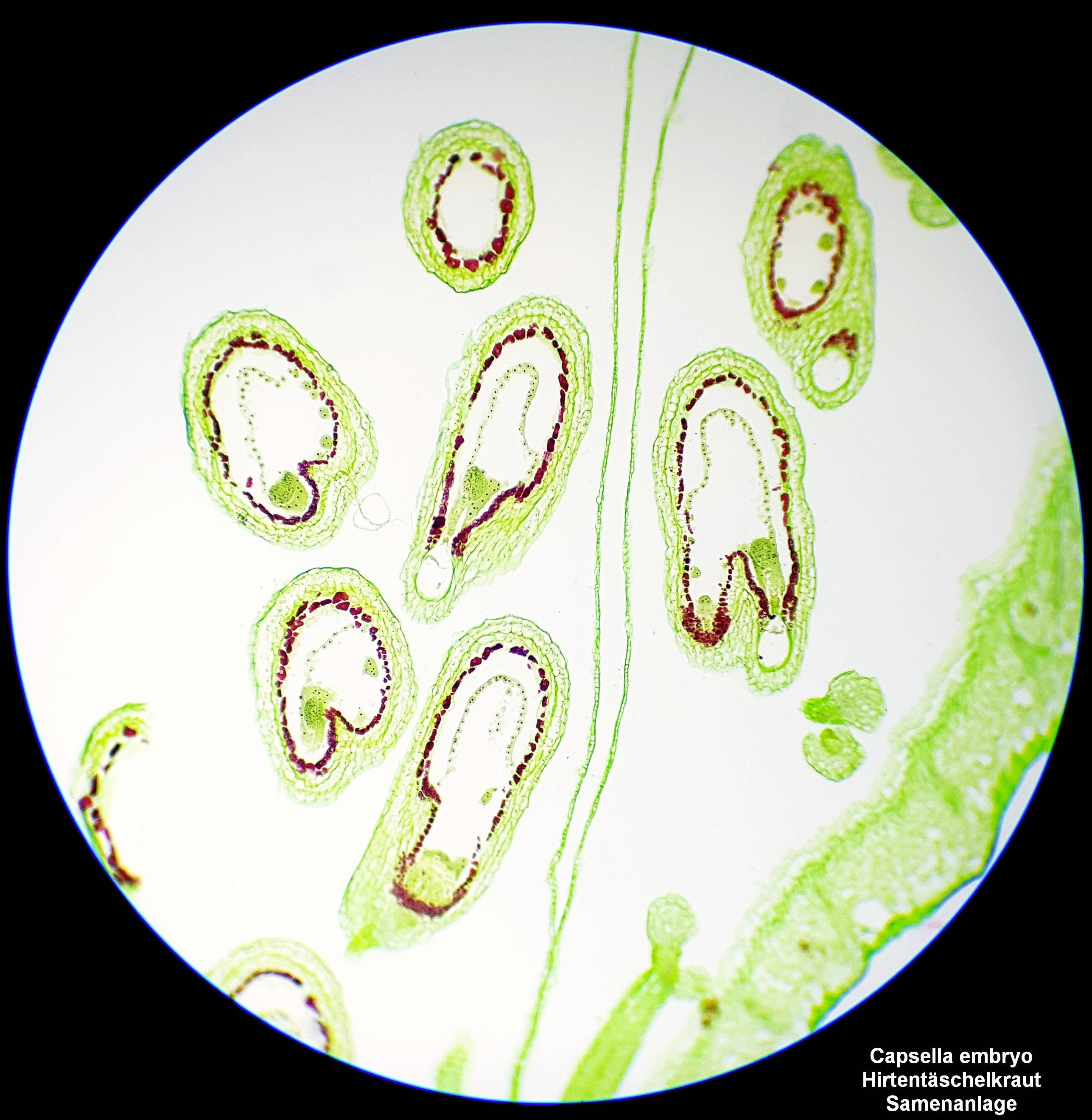 Bresser Optik 5750800 Science TFM-201 Bino Durchlichtmikroskop Binokular 1000 x Durchlicht