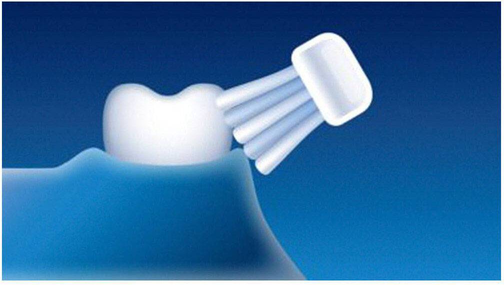 Philips Bodycare Easyclean HX6511/33 HX6511/33 Elektrische Zahnbürste Schallzahnbürste Weiß