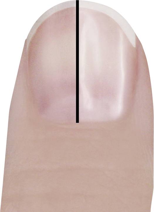 Trisa Perfect Nails Maniküre-Pediküre-Set
