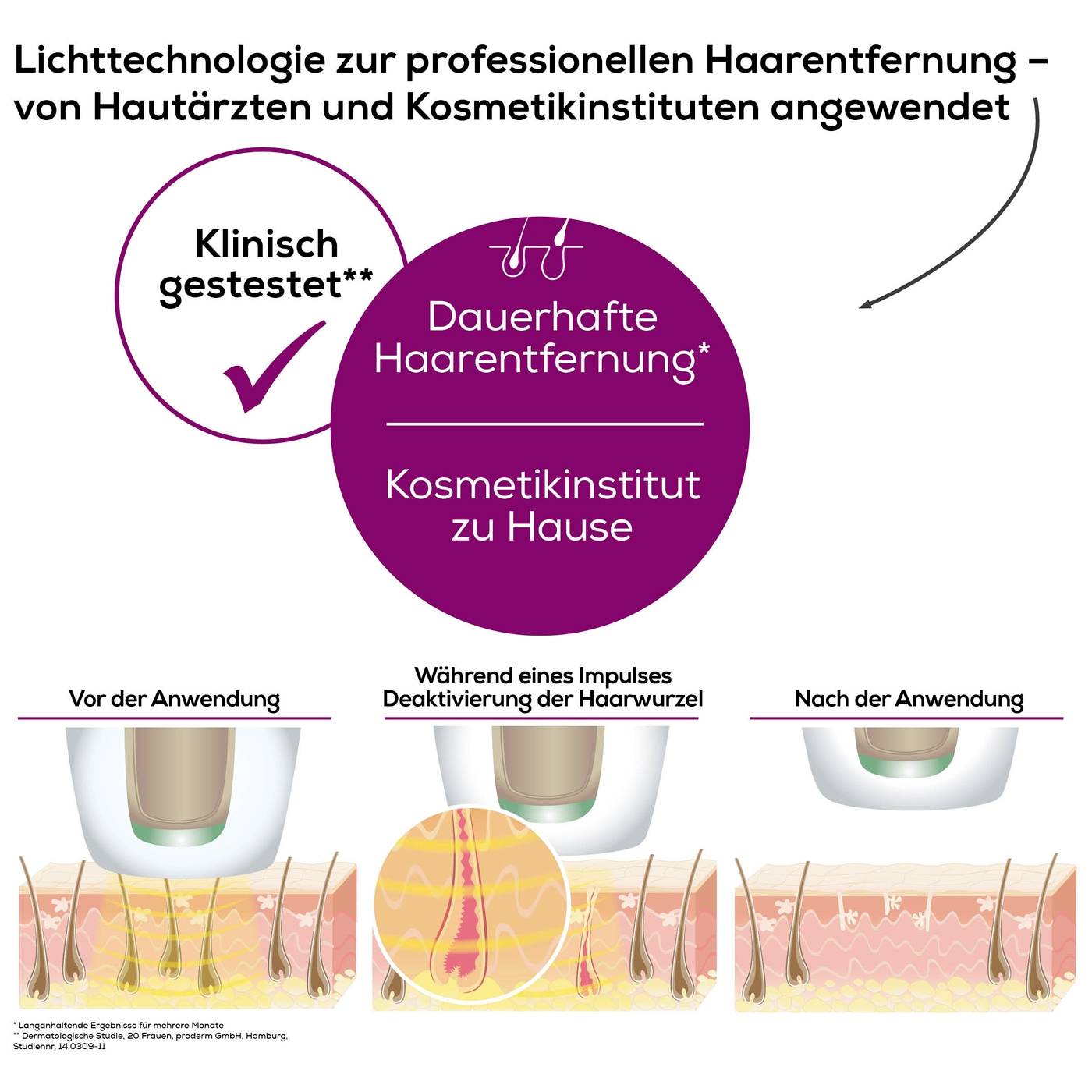 Beurer IPL Velvet Skin Pro 57513 IPL Haarentferner