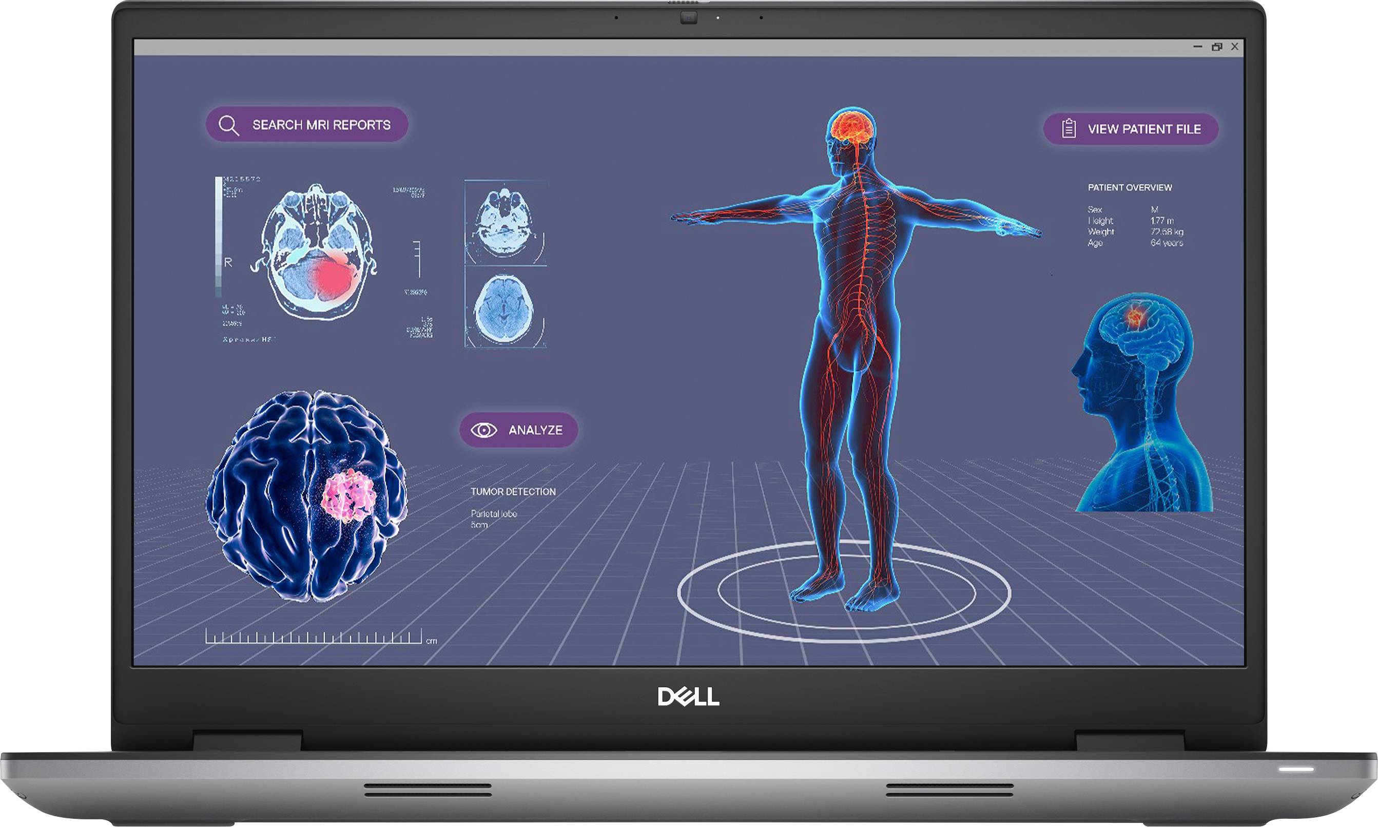 Dell Workstation Notebook Precision 7780 43.9cm (17.3 Zoll) Full HD Intel® Core™ i9 i9-13950HX 32GB RAM 1TB SSD Deutsch, QWERTZ G