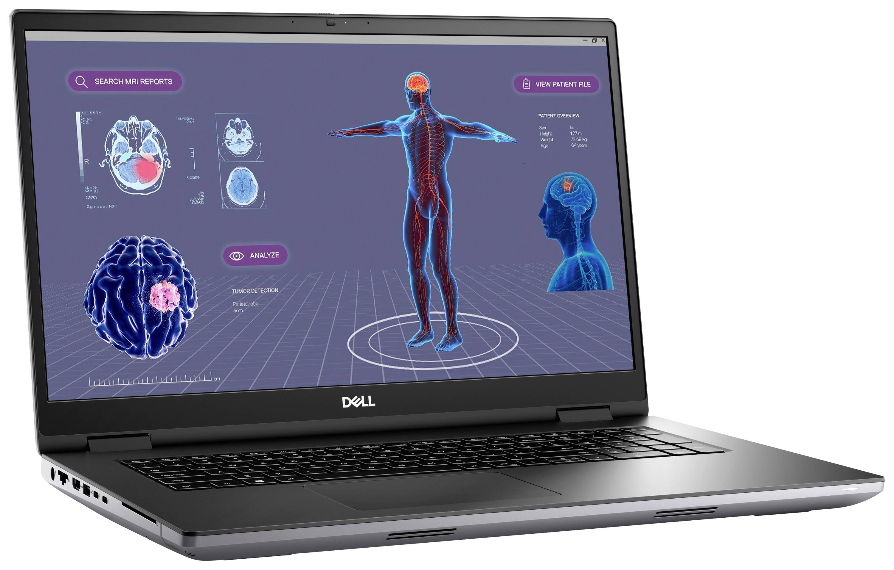 Dell Workstation Notebook Precision 7780 43.9cm (17.3 Zoll) Full HD Intel® Core™ i9 i9-13950HX 32GB RAM 1TB SSD Deutsch, QWERTZ G