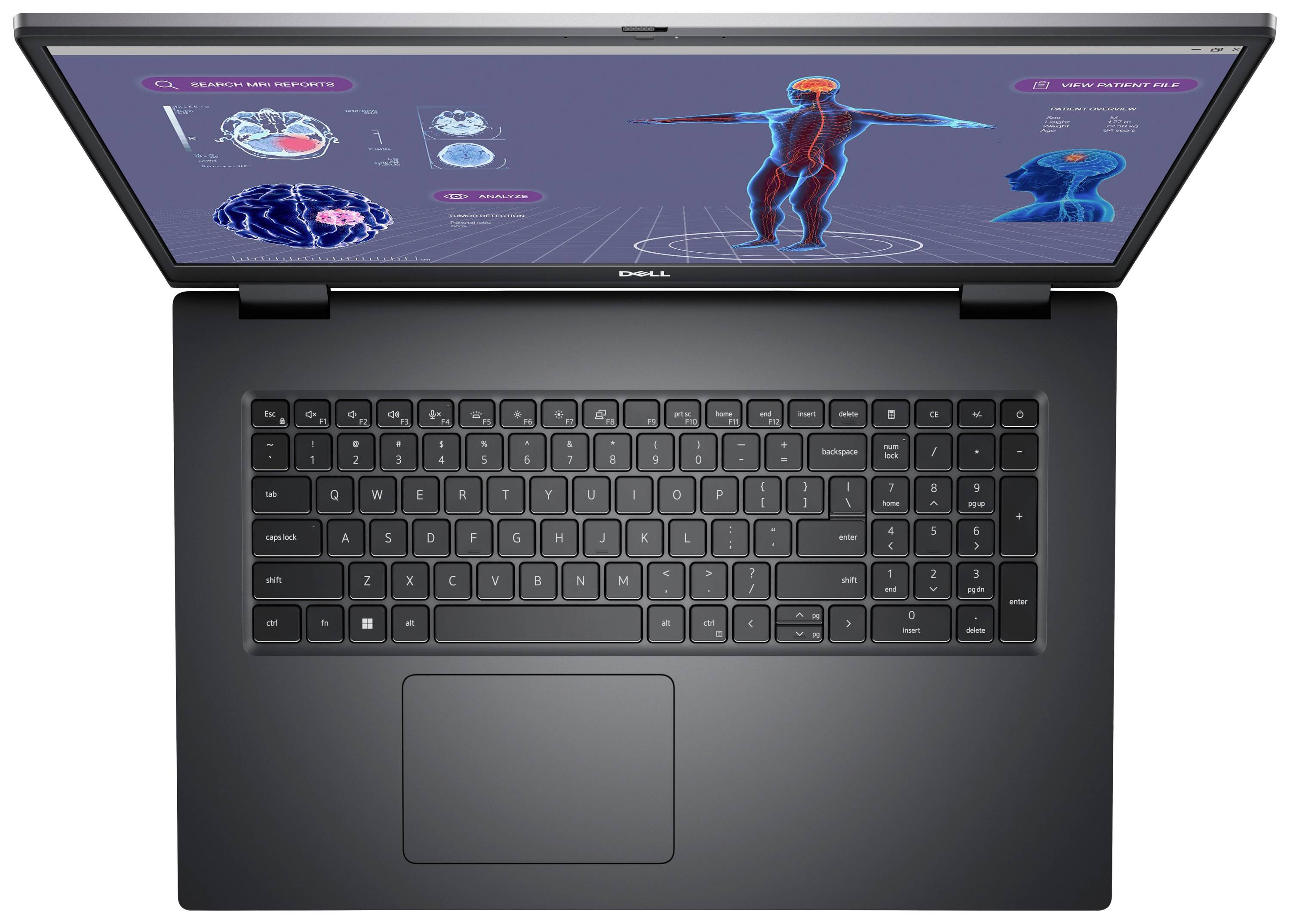 Dell Workstation Notebook Precision 7780 43.9cm (17.3 Zoll) Full HD Intel® Core™ i7 i7-13850HX 32GB RAM 1TB SSD Deutsch, QWERTZ