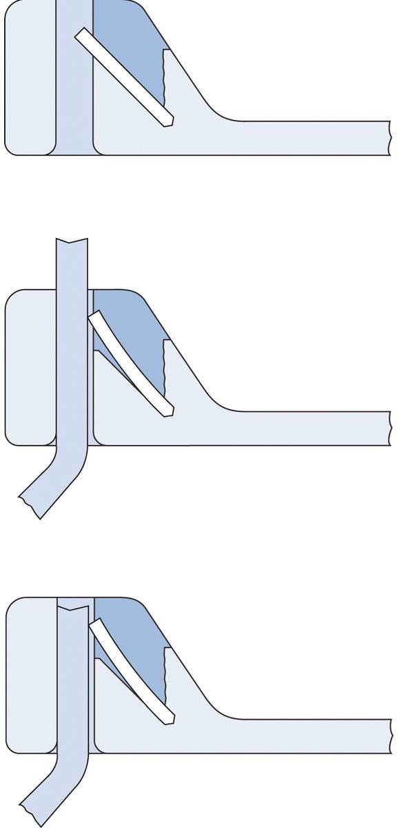 LAPP 61723020 KABELBINDER TY-RAP TYB 24 MX 140X3,6 BK Kabelbinder 1000St.