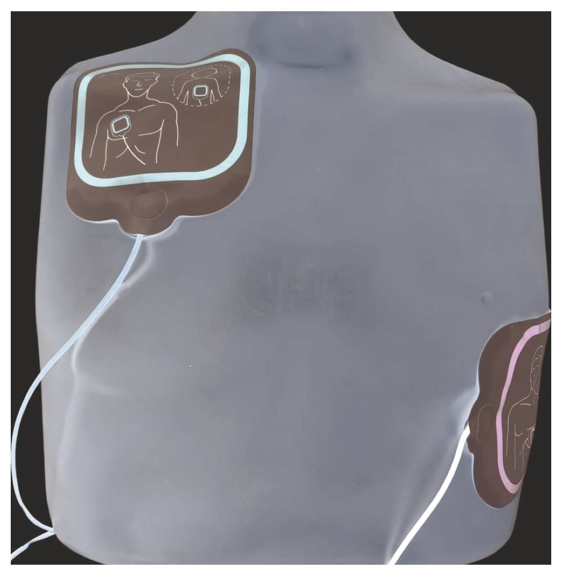 „Zwei Elektrodenpflaster auf der Brust eines Trainingsmotoriks angebracht, die die Platzierung für das Defibrillationstraining veranschaulichen, mit einem Pflaster auf der oberen rechten Brust und einem auf der Seite.