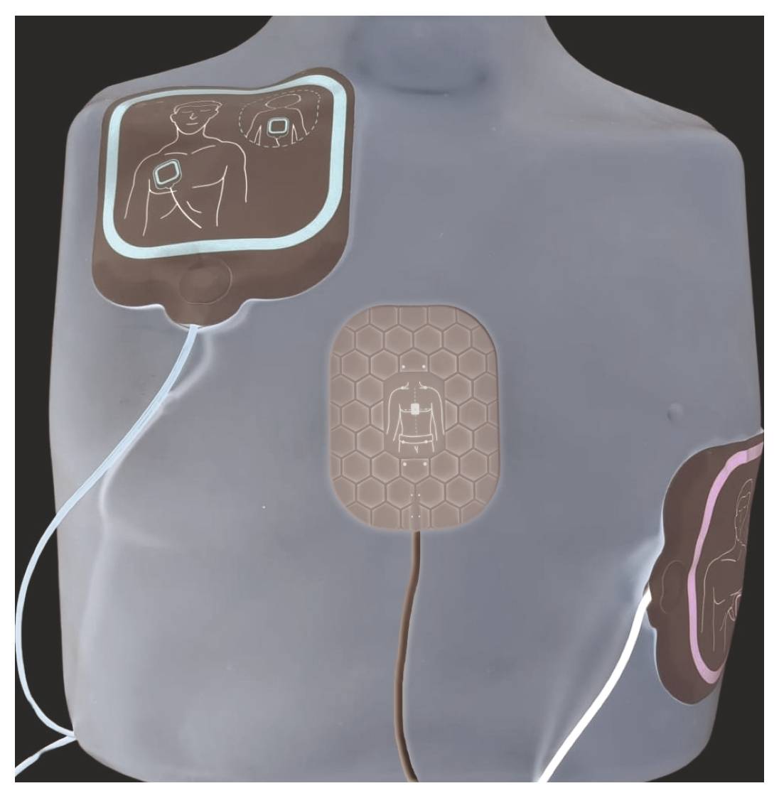 Ein roter Tragekoffer mit einem Anzeitefenster, das 