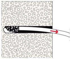 Diagramm zeigt einen Katheter, der durch Gewebe führt, mit einem roten Pfeil, der eine Bewegung nach rechts anzeigt.