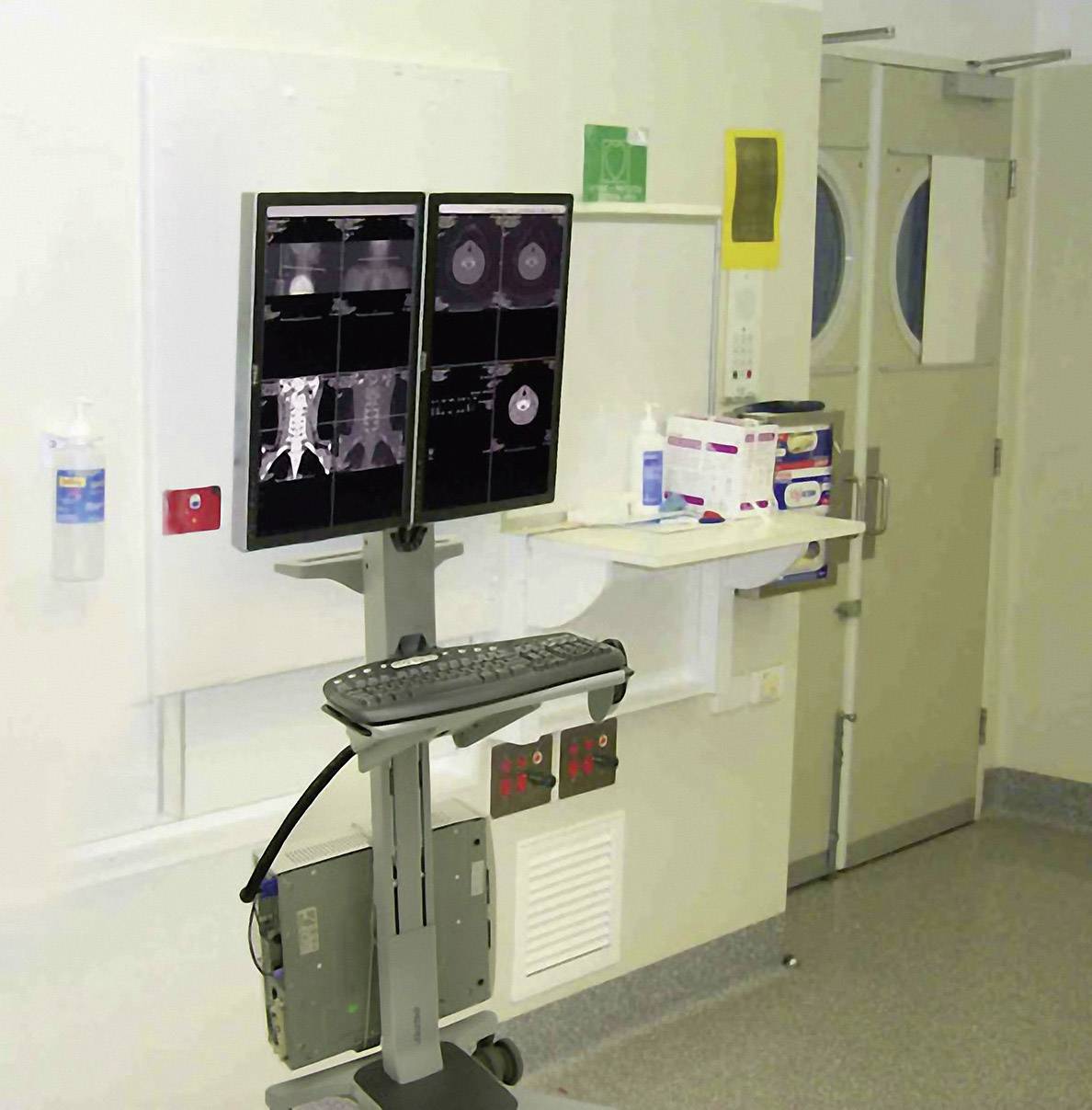 Ein medizinischer Monitorwagen zeigt Röntgenbilder auf zwei Bildschirmen in einer Krankenhausumgebung neben einer Wand mit Medizinbedarf.