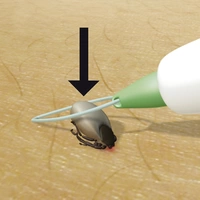 3iX tick sling Zeckenschlinge Weiß 1St. 3iX tick sling Zeckenschlinge Weiß 1St.