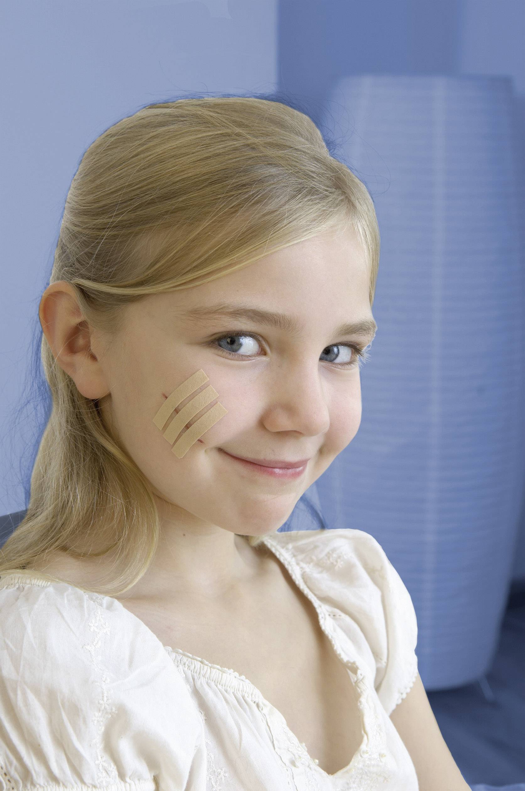 3M YP202700008 Wundverschlussstreifen