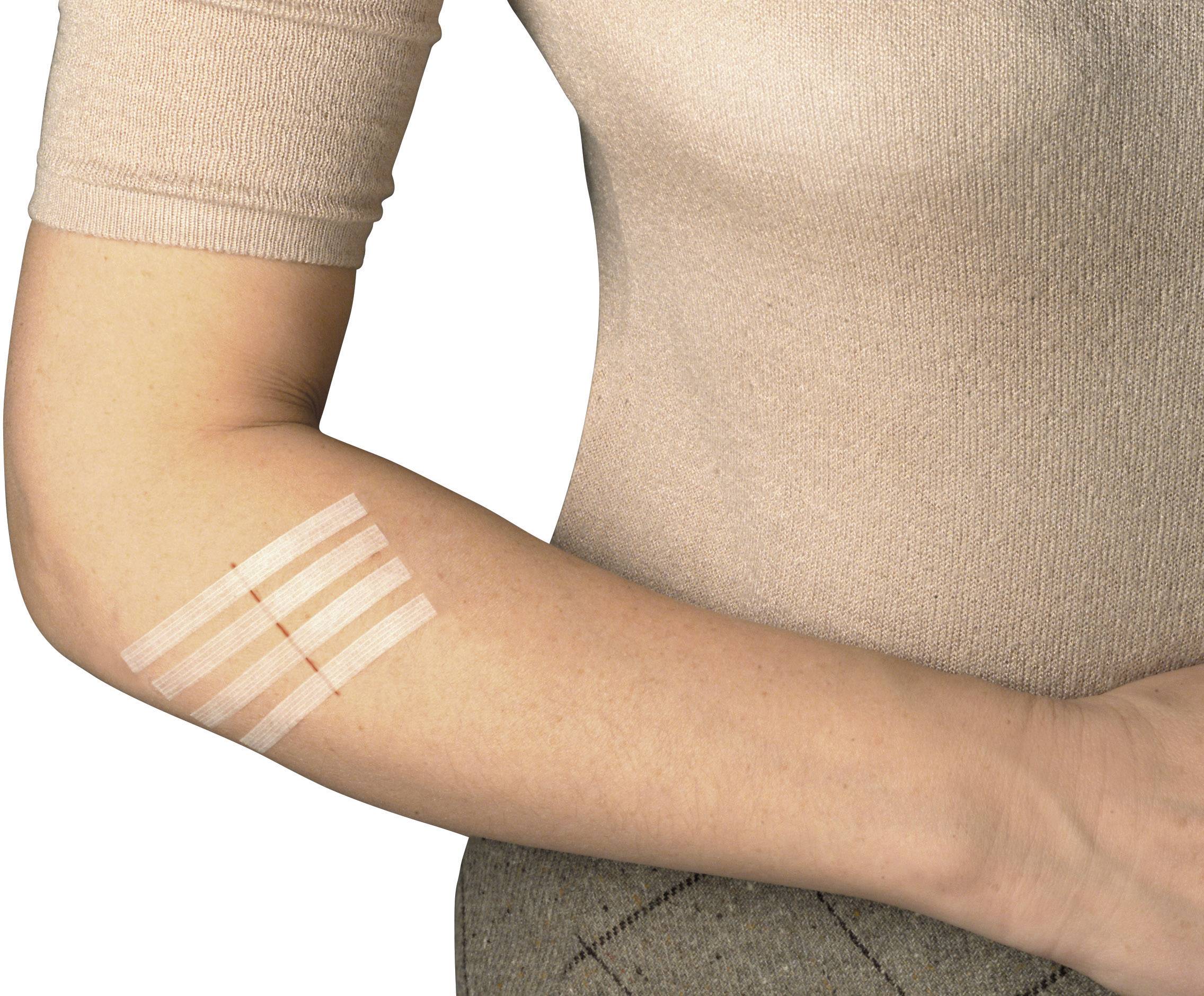 3M YP202700008 Nexcare™ Steri-Strips™ Wundverschlussstreifen