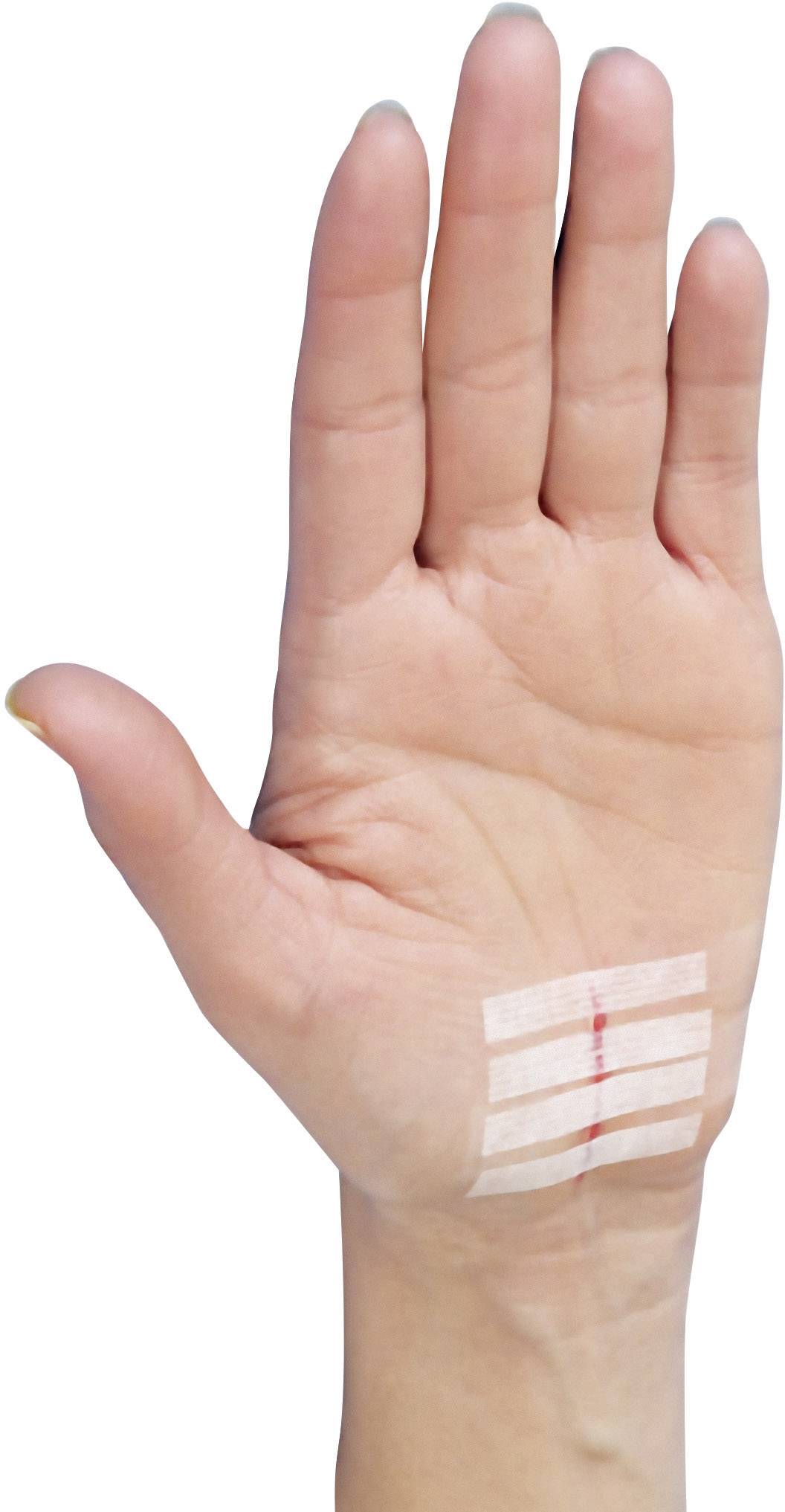 3M YP202700008 Nexcare™ Steri-Strips™ Wundverschlussstreifen