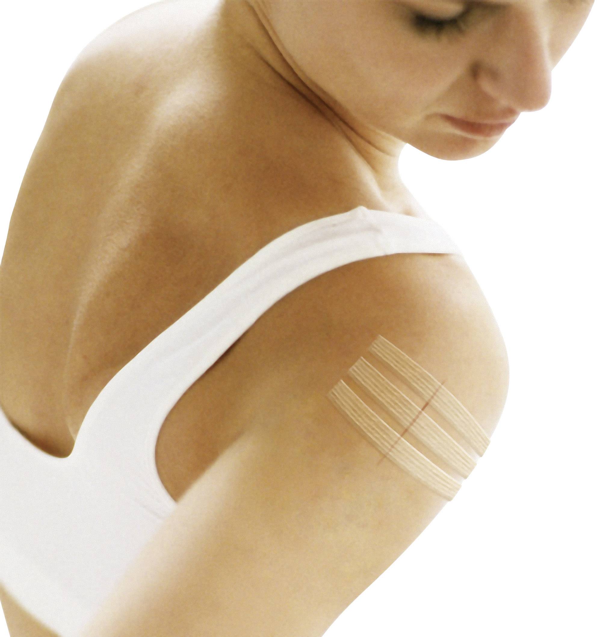 3M YP202700008 Nexcare™ Steri-Strips™ Wundverschlussstreifen