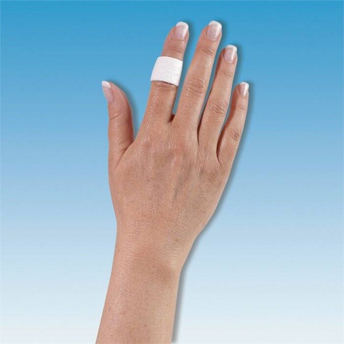 Fingerverband aluderm-aluplast elastisch 100 St./VE Söhngen