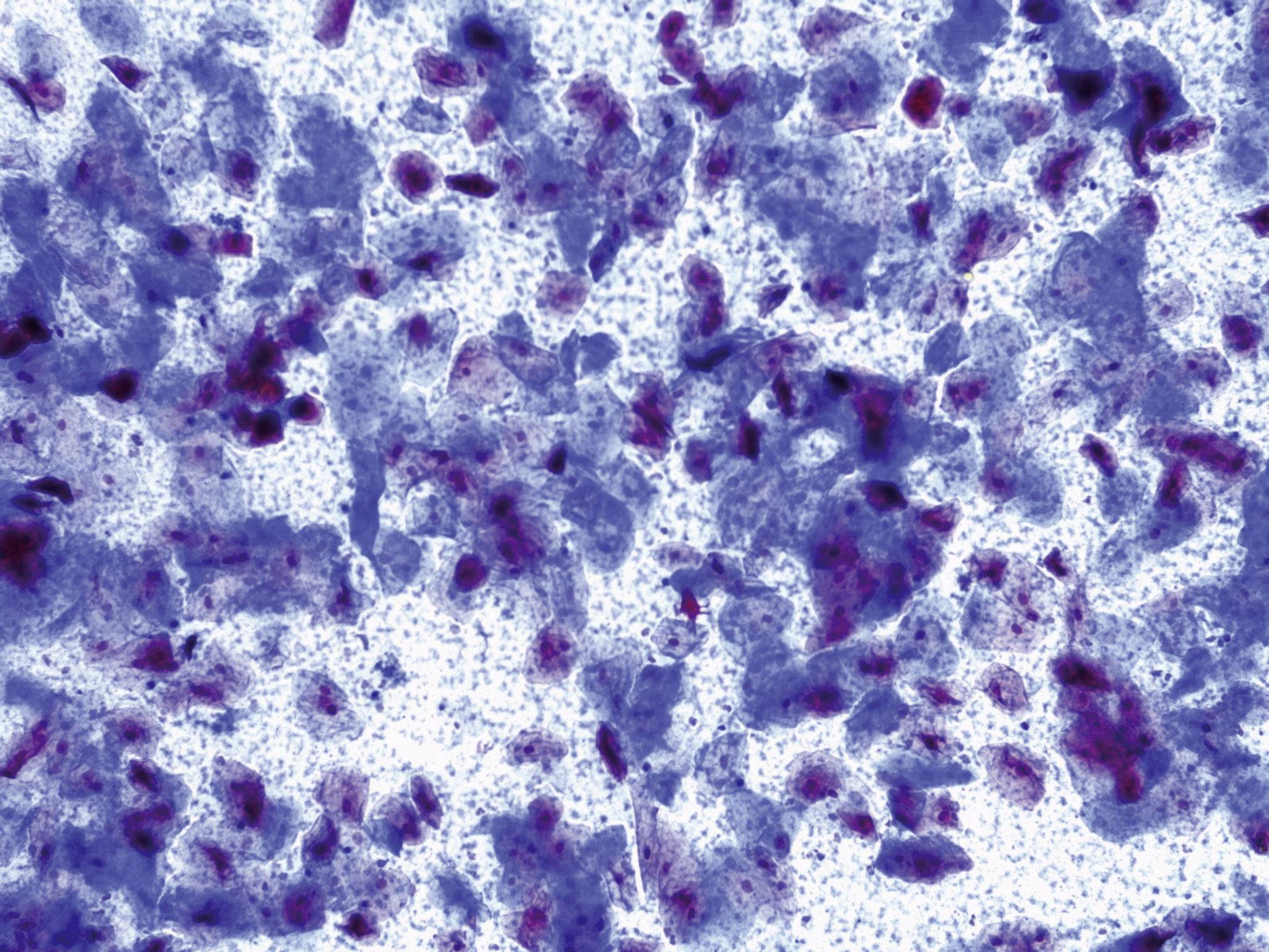 Leica Microsystems 13613383 DM300 Durchlichtmikroskop Monokular 1000 x Durchlicht