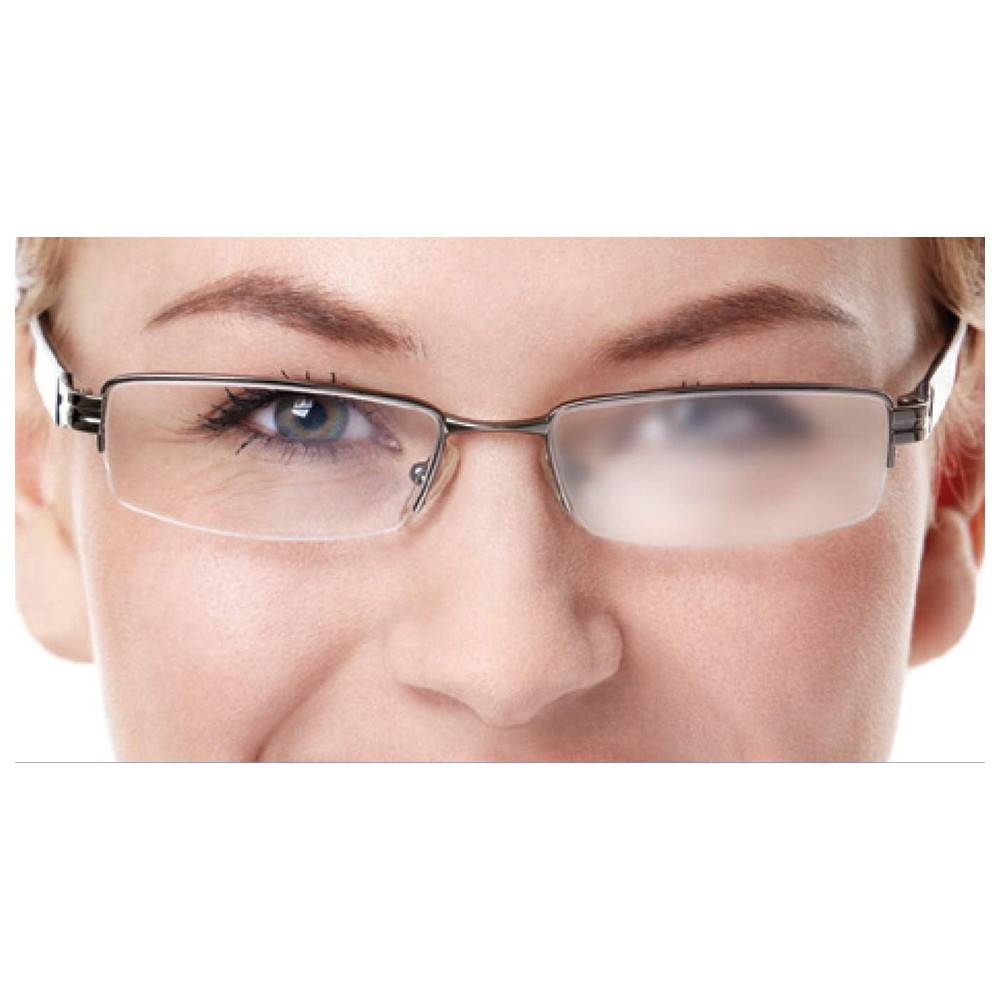 Zeiss AntiBESCHLAG-Set, 15 ml Spray + Tuch