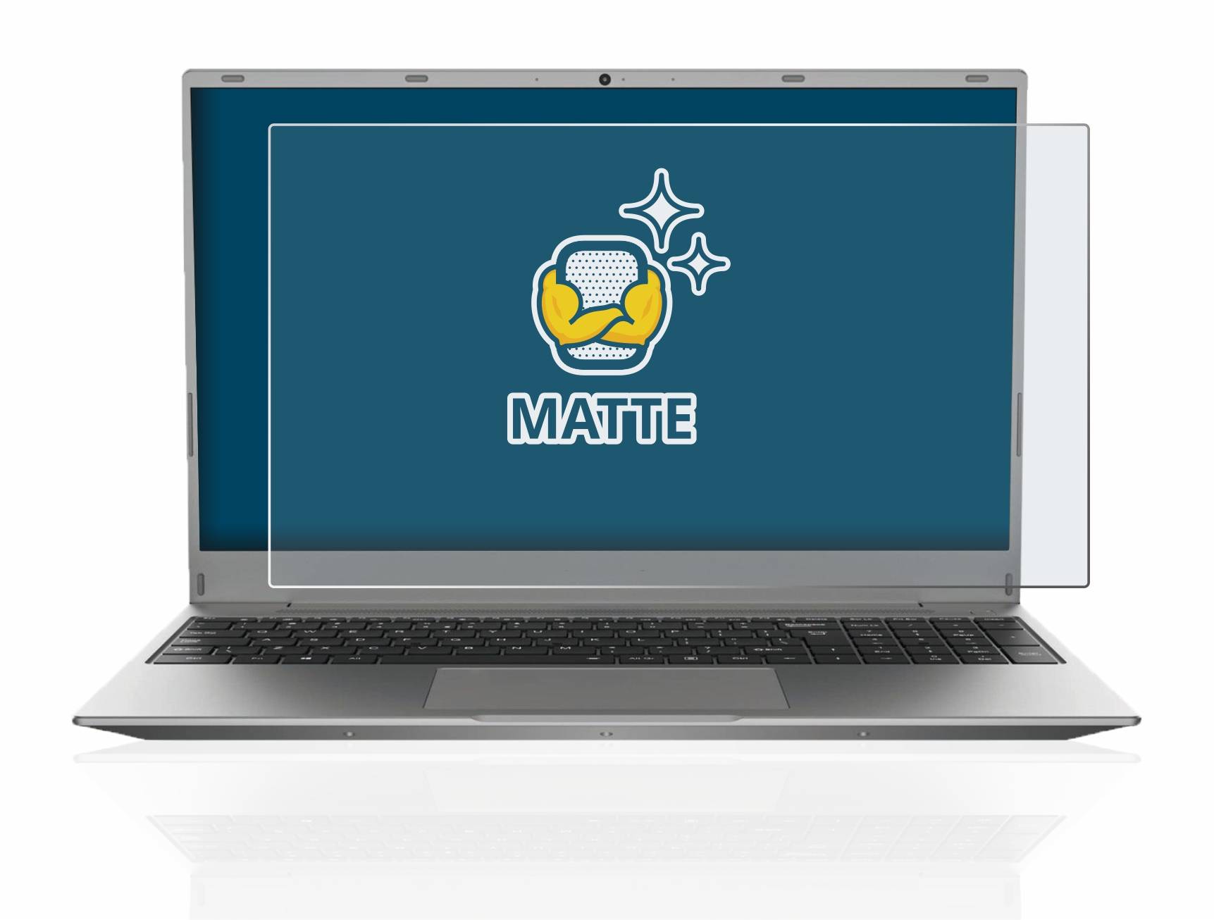 BROTECT Schutzfolie für MEDION Akoya E16402 16.1" Folie Matt Entspiegelt
