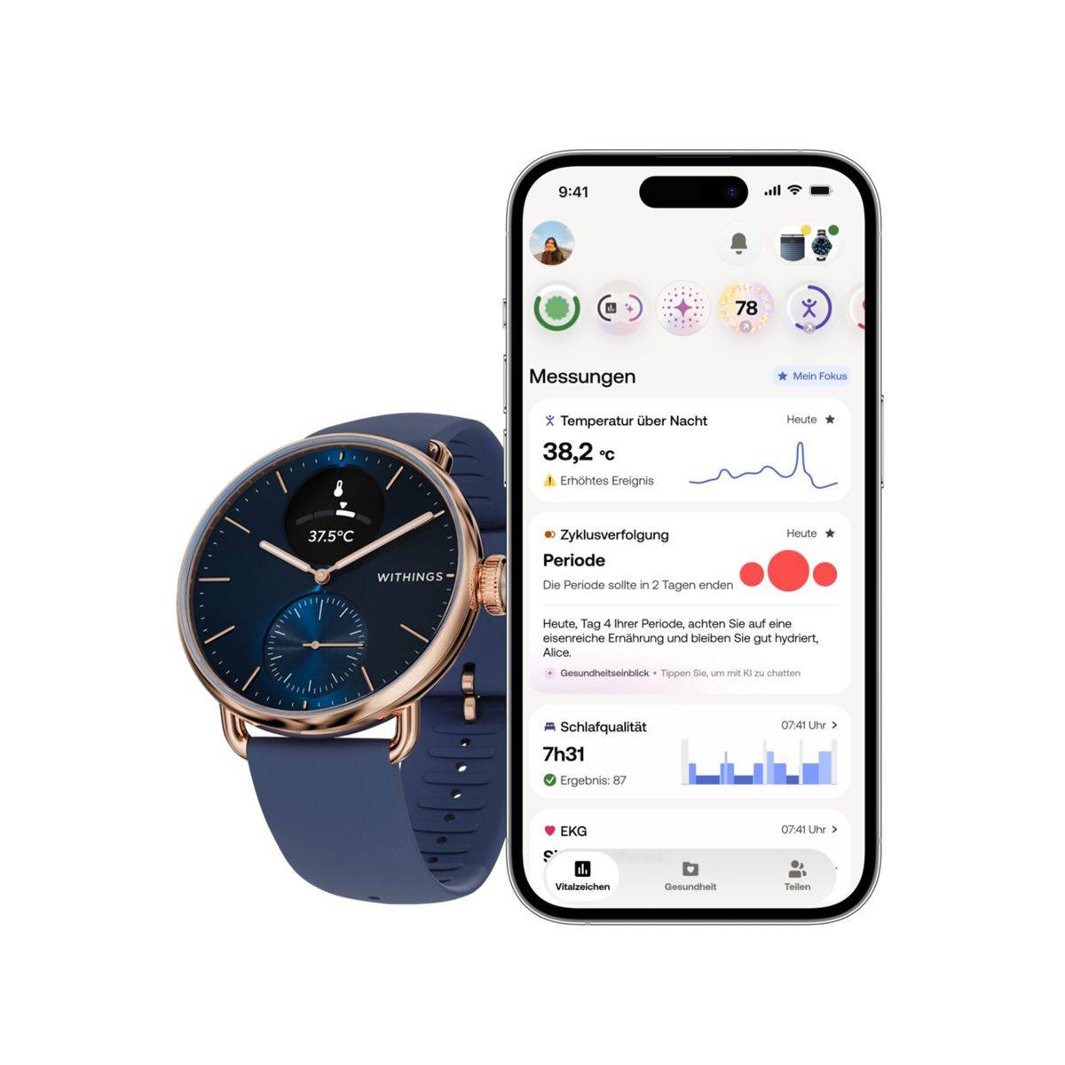 ScanWatch 2 38mm Rose Gold Blue