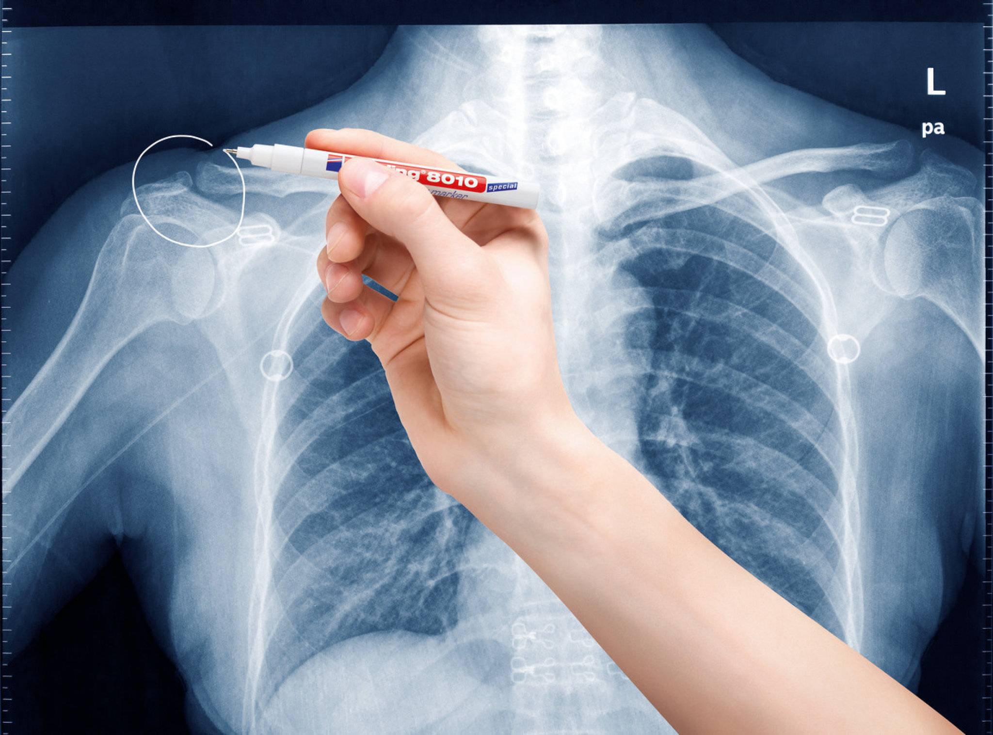 edding 8010 Röntgenmarker weiß