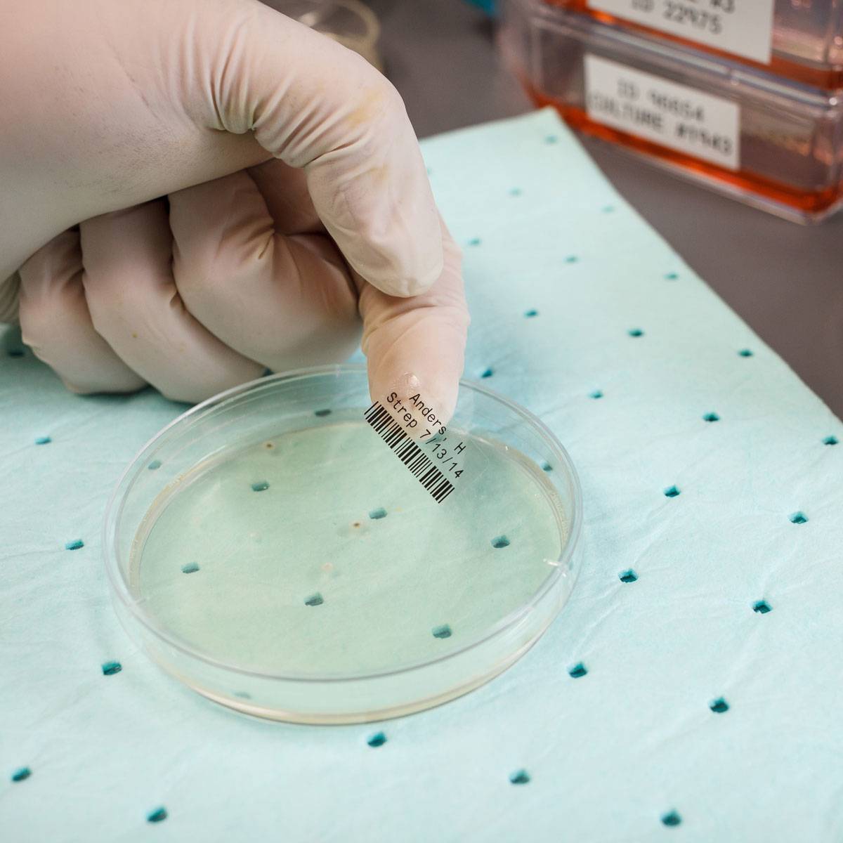 Behandschuhte Hand platziert eine beschriftete Probenscheibe in eine durchsichtige Petrischale auf einem sterilen blauen Labortuch.