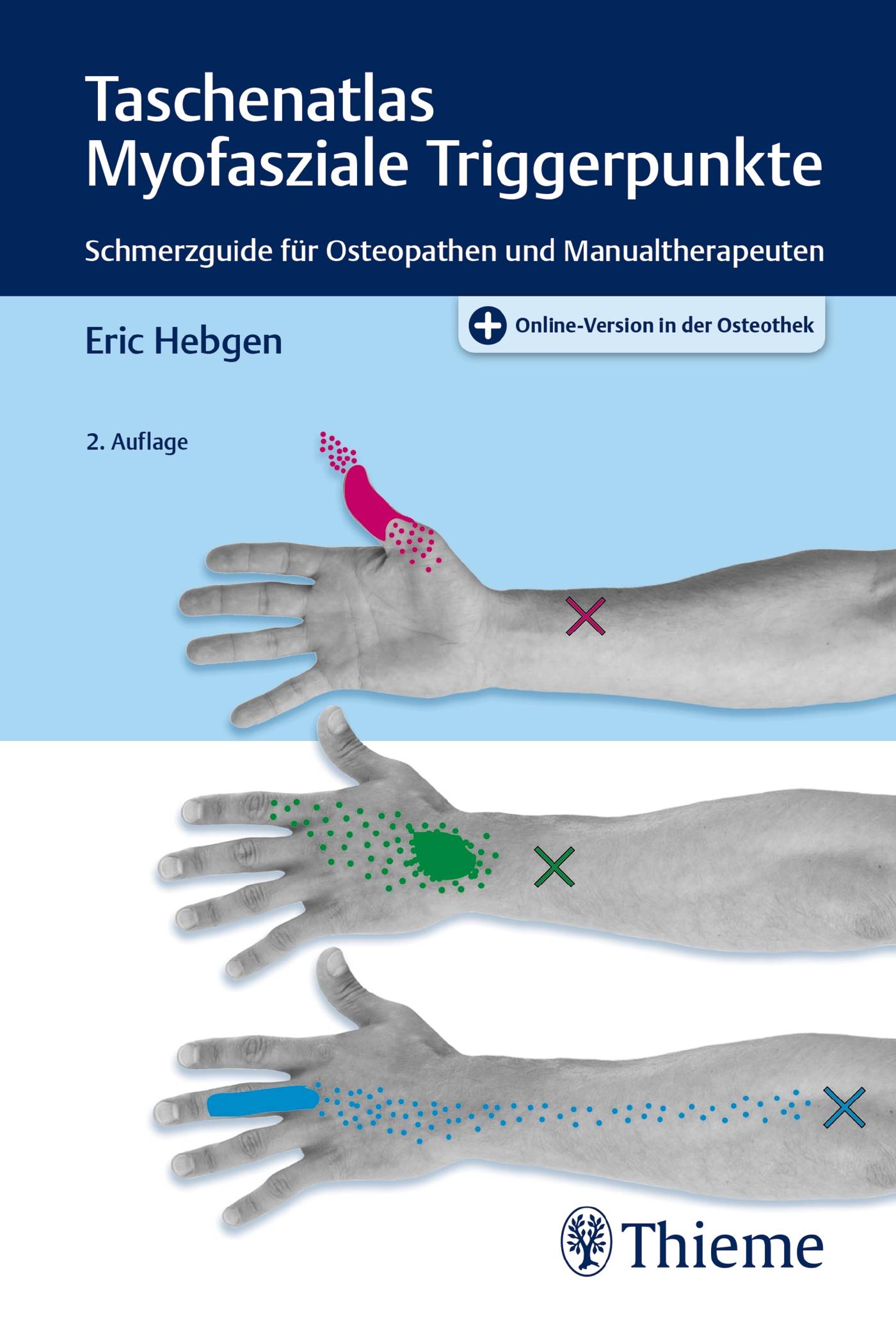 Taschenatlas Myofasziale Triggerpunkte Schmerzguide für Osteopathen und Manualtherapeuten