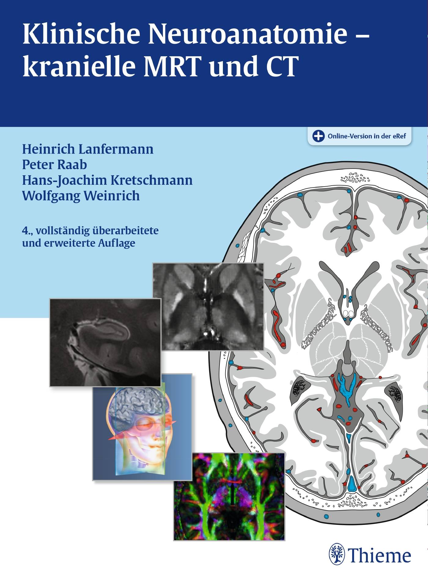Klinische Neuroanatomie - kranielle MRT und CT Plus Online-Version in der eRef