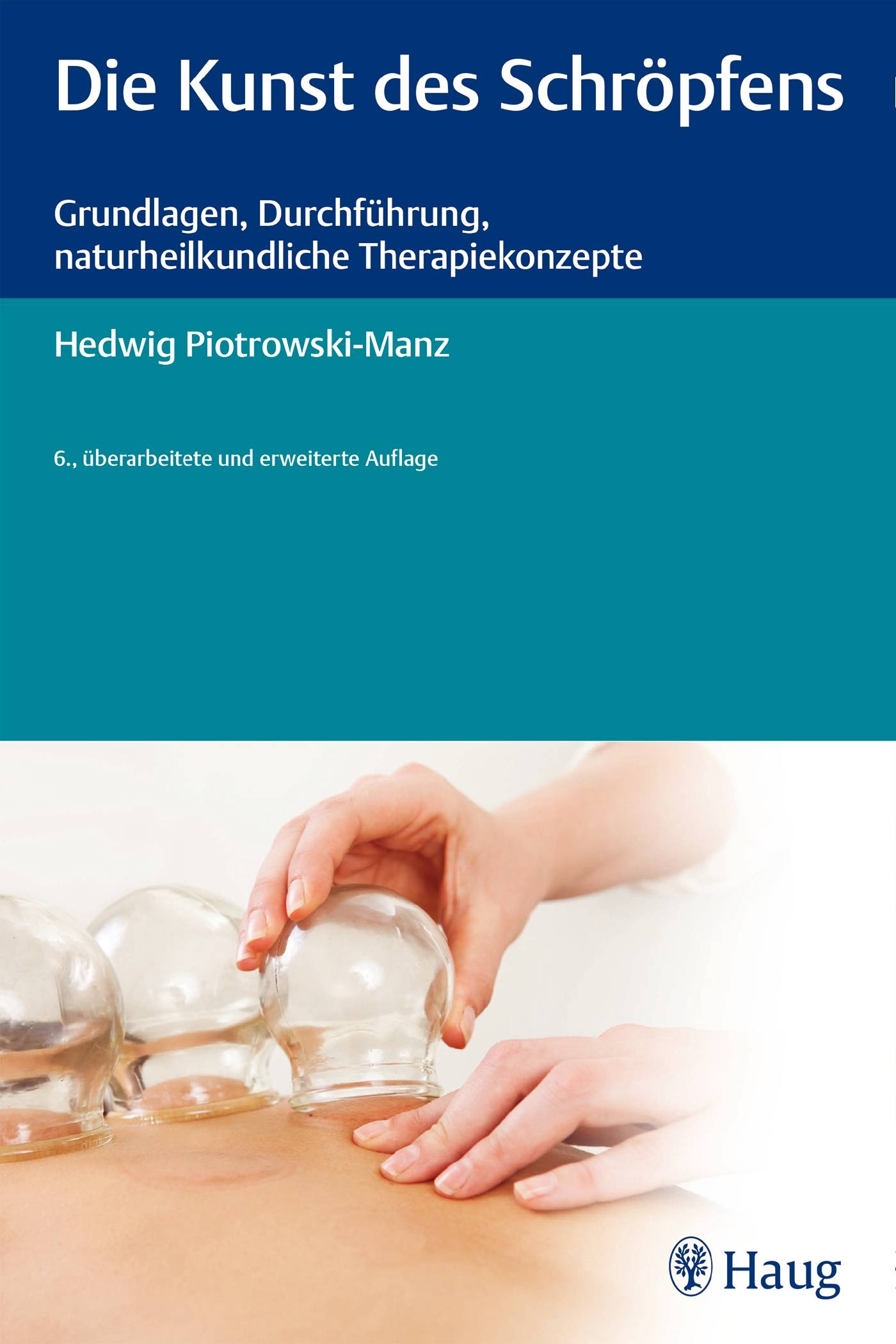 Die Kunst des Schröpfens Grundlagen, Durchführung, naturheilkundliche Therapiekonzepte