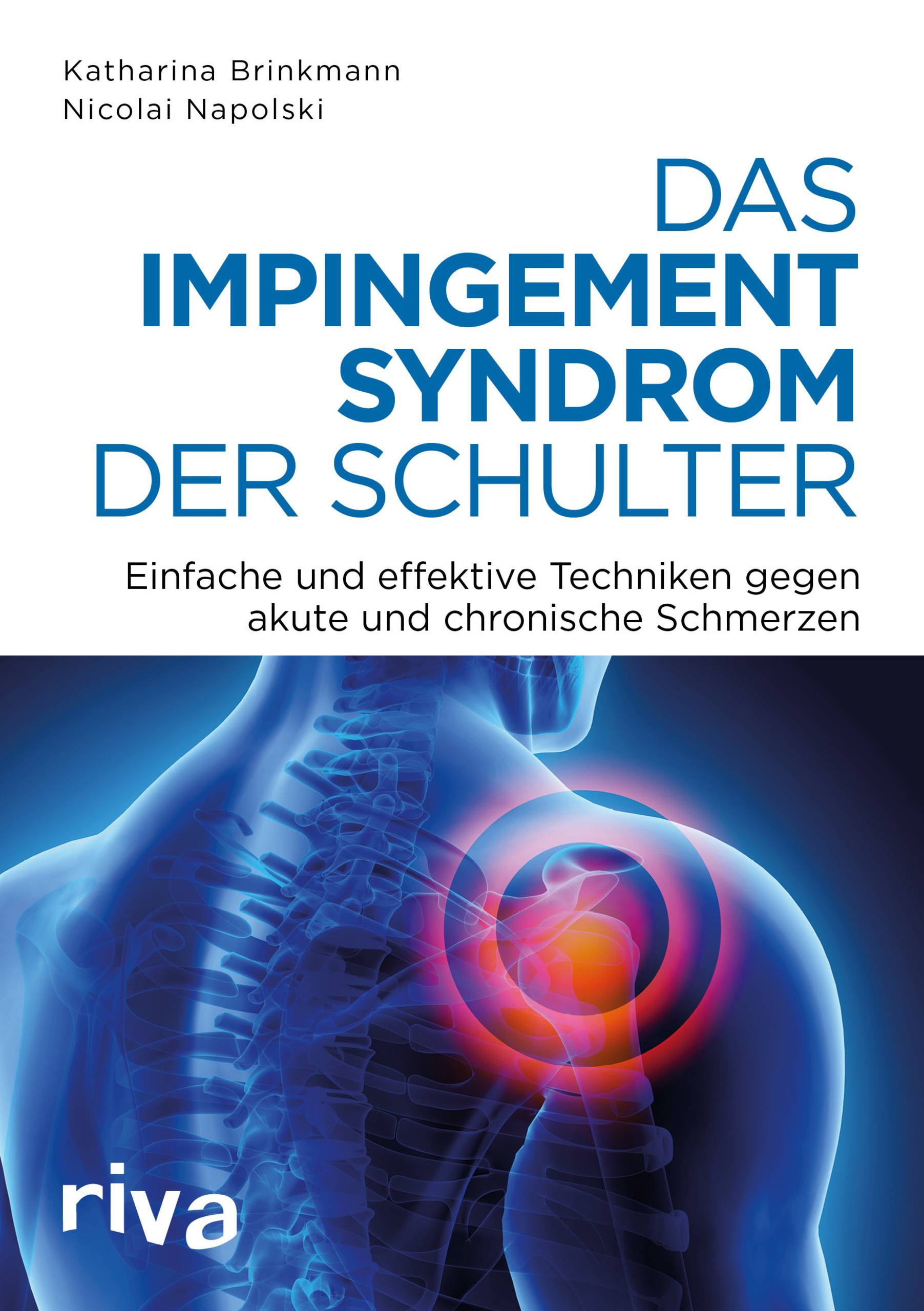 Das Impingement-Syndrom der Schulter Einfache und effektive Techniken gegen akute und chronische Schmerzen