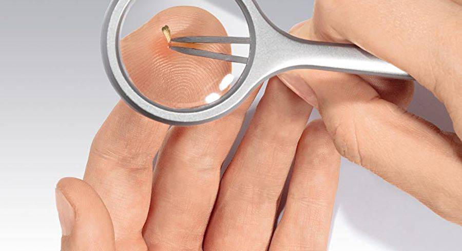 Lupenpinzette mit LED-Beleuchtung, TRIZETTE, 4fach Vergrößerung, inklusive Batterien