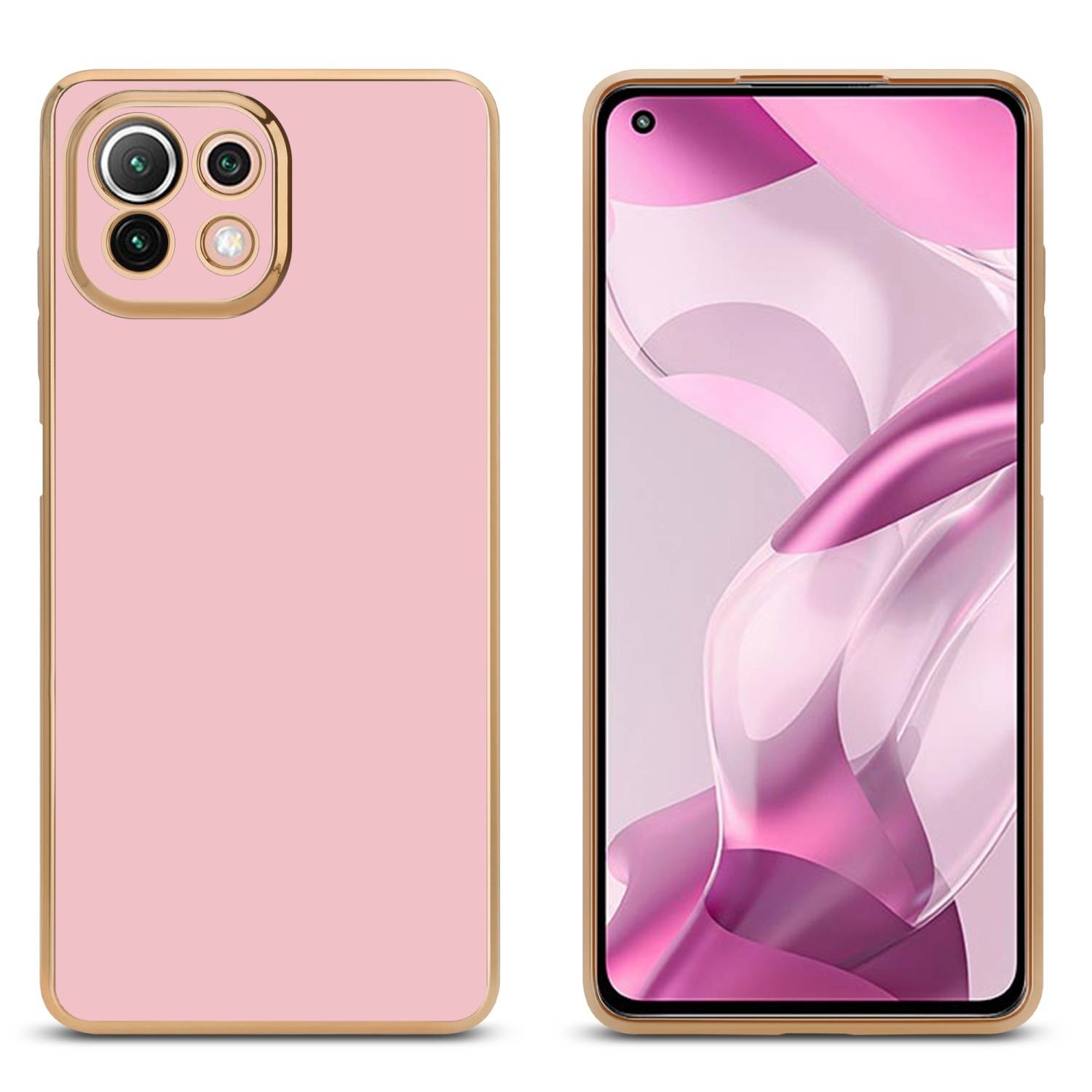 Cadorabo Schutzhülle für Xiaomi Mi 11 LITE (4G / 5G) / 11 LITE NE Hülle in Rosa Handyhülle TPU Silikon Kameraschutz Etui