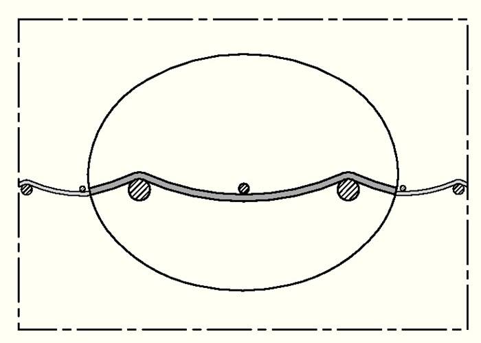 Querschnittsdiagramm eines Auges mit einer detaillierten Ansicht seiner inneren Krümmung, einschließlich Linse und Netzhaut.