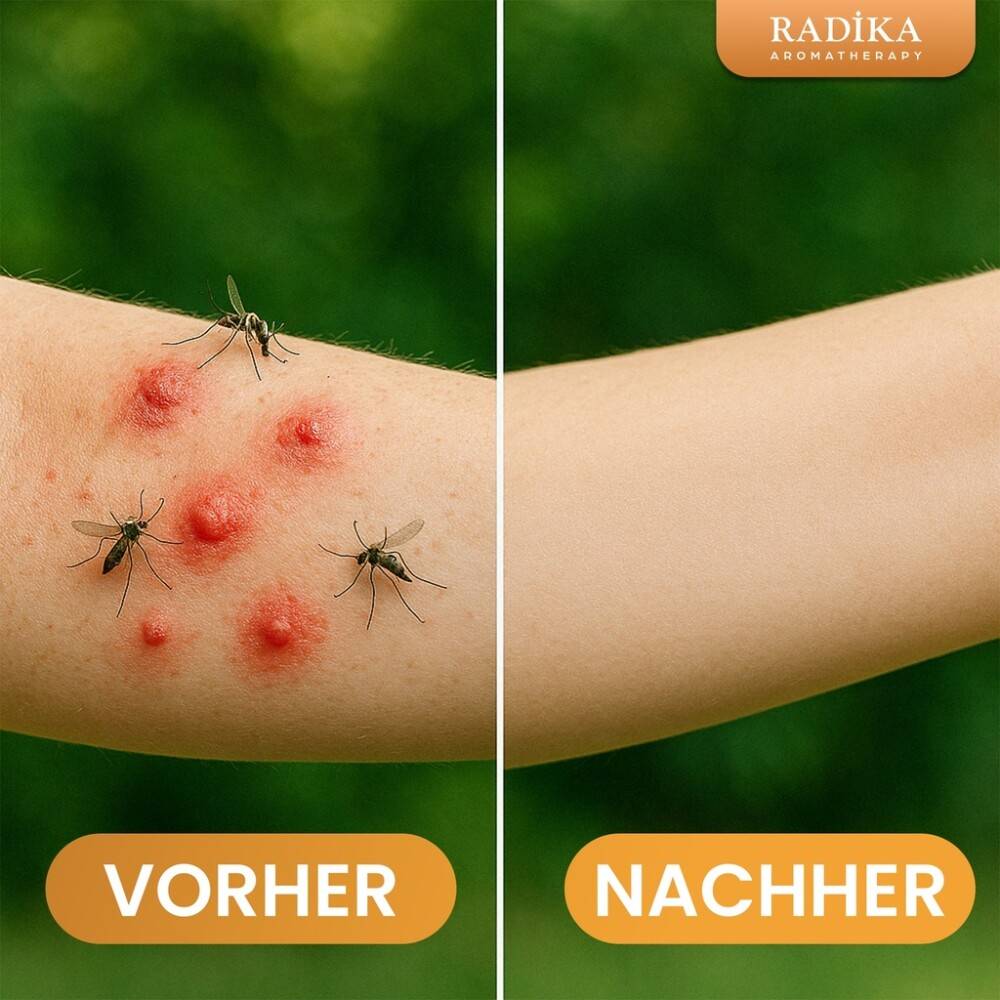 Mosquito Repellent Air Spray, Fliegenspray, 100% Rein, BIO, natürlich, 250 ml