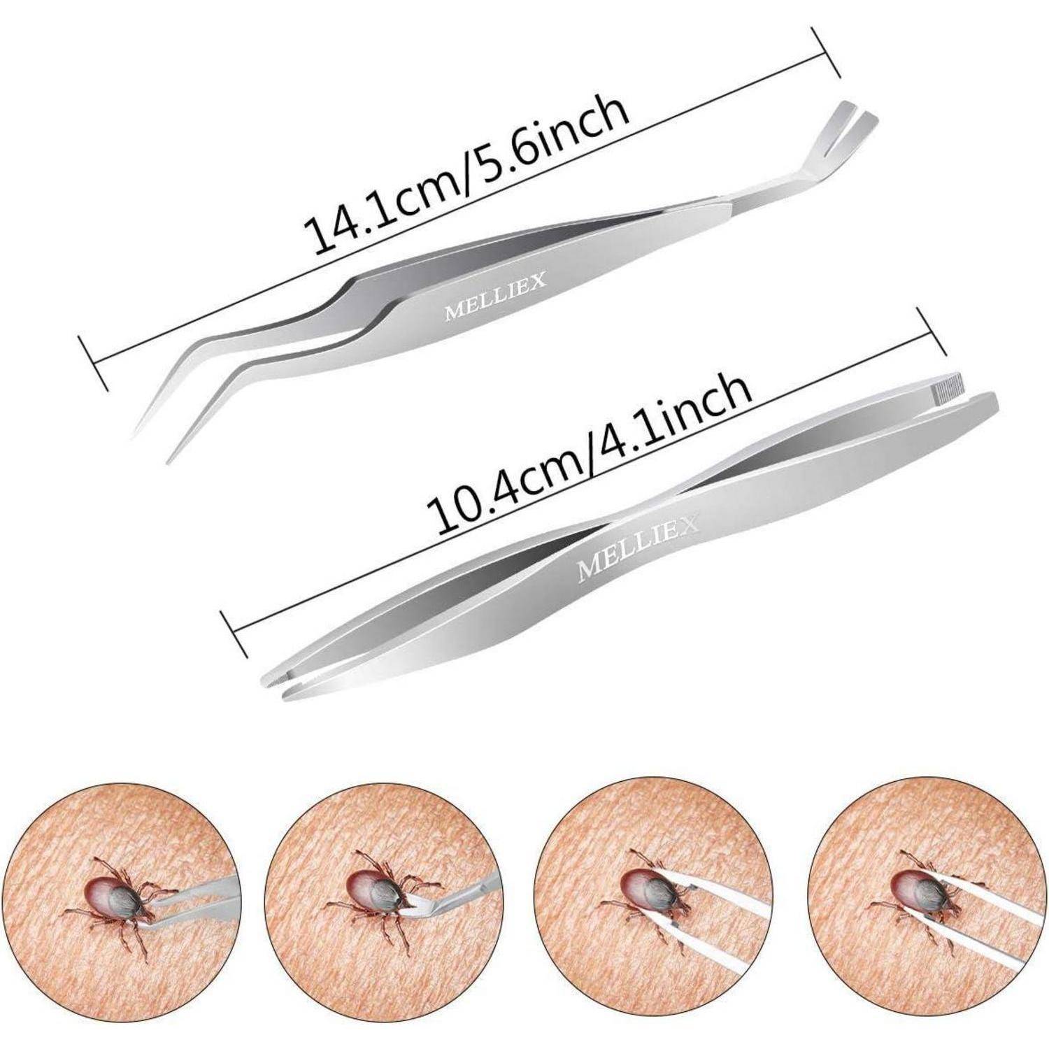 Pinzetten-Set mit Maßangaben: 14,1 cm/5,6 Zoll und 10,4 cm/4,1 Zoll. Die unteren Bilder zeigen eine Zecke, die mit einer Pinzette von der Haut entfernt wird.