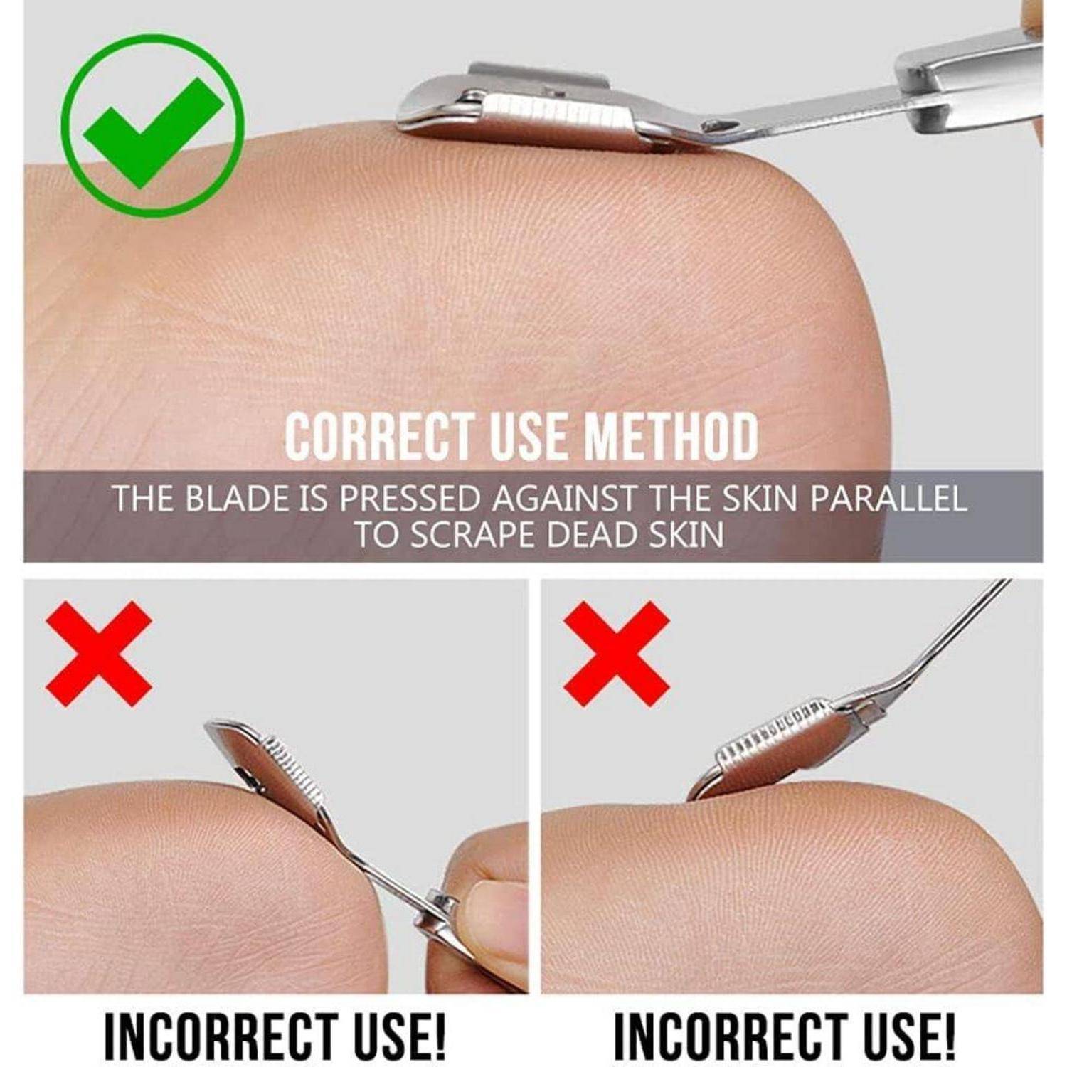Das obere Bild zeigt die korrekte Anwendung eines Hornhautschabers mit parallel zur Haut gehaltenem Messer. Die unteren Bilder zeigen eine falsche, schräge Anwendung mit der Beschriftung 