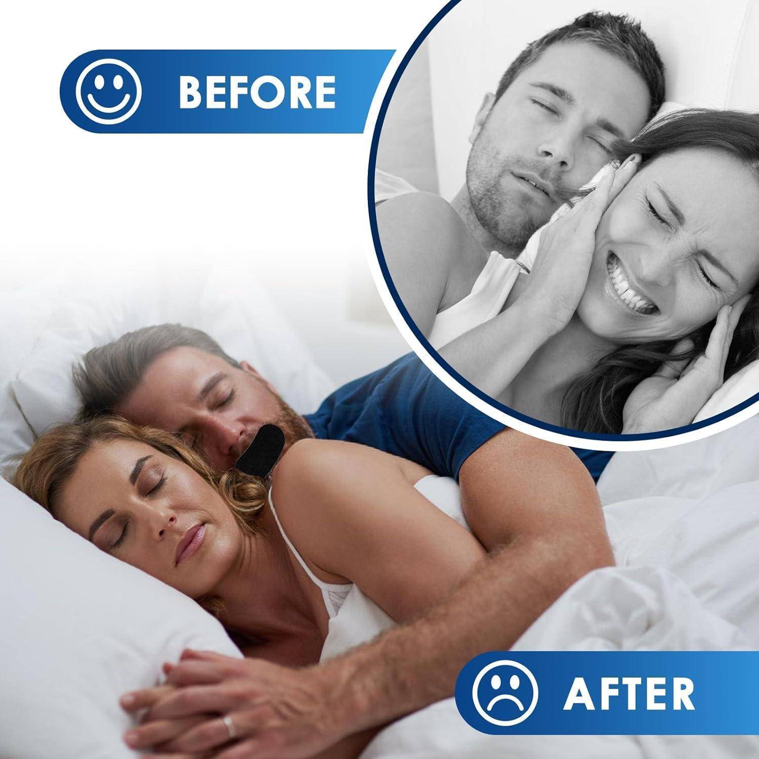Ein Paar schläft friedlich auf dem 'Vorher'-Bild, während das 'Nachher'-Bild einen Partner zeigt, der verärgert aussieht, während der andere schnarcht.