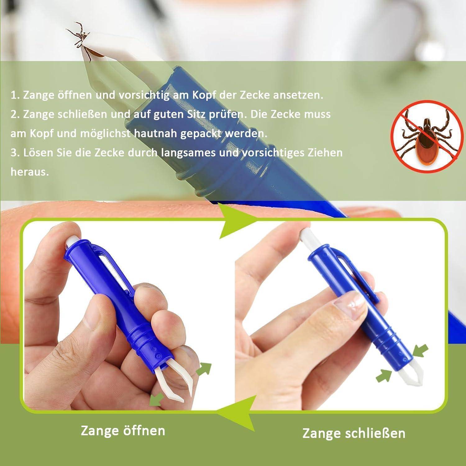 Zeckenzange Hund Katze 5er Set Zeckenhaken Grün Blau mit Edelstahl