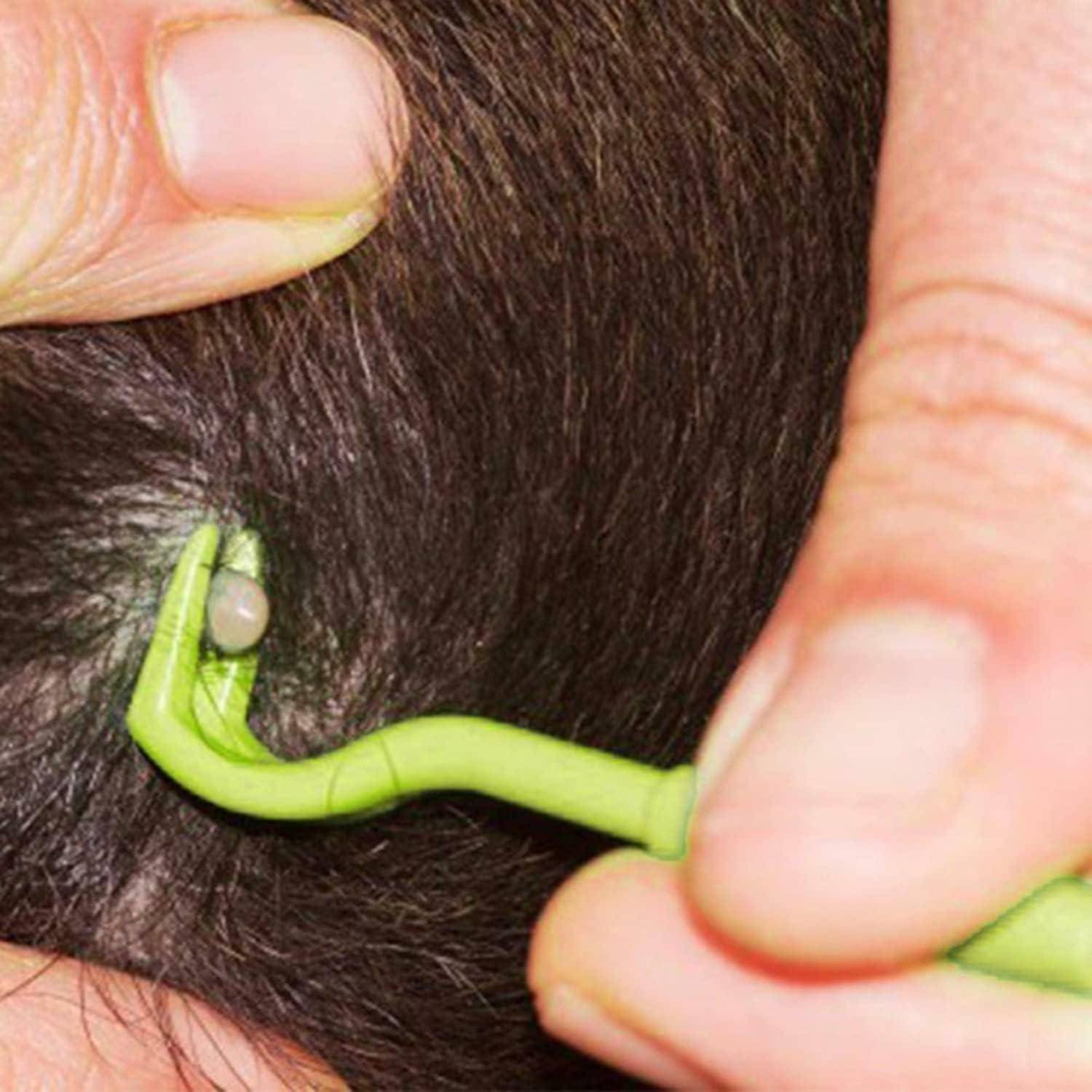 Zeckenhaken 3 Größen Set Zeckenzange Hund Katze Mensch Grün