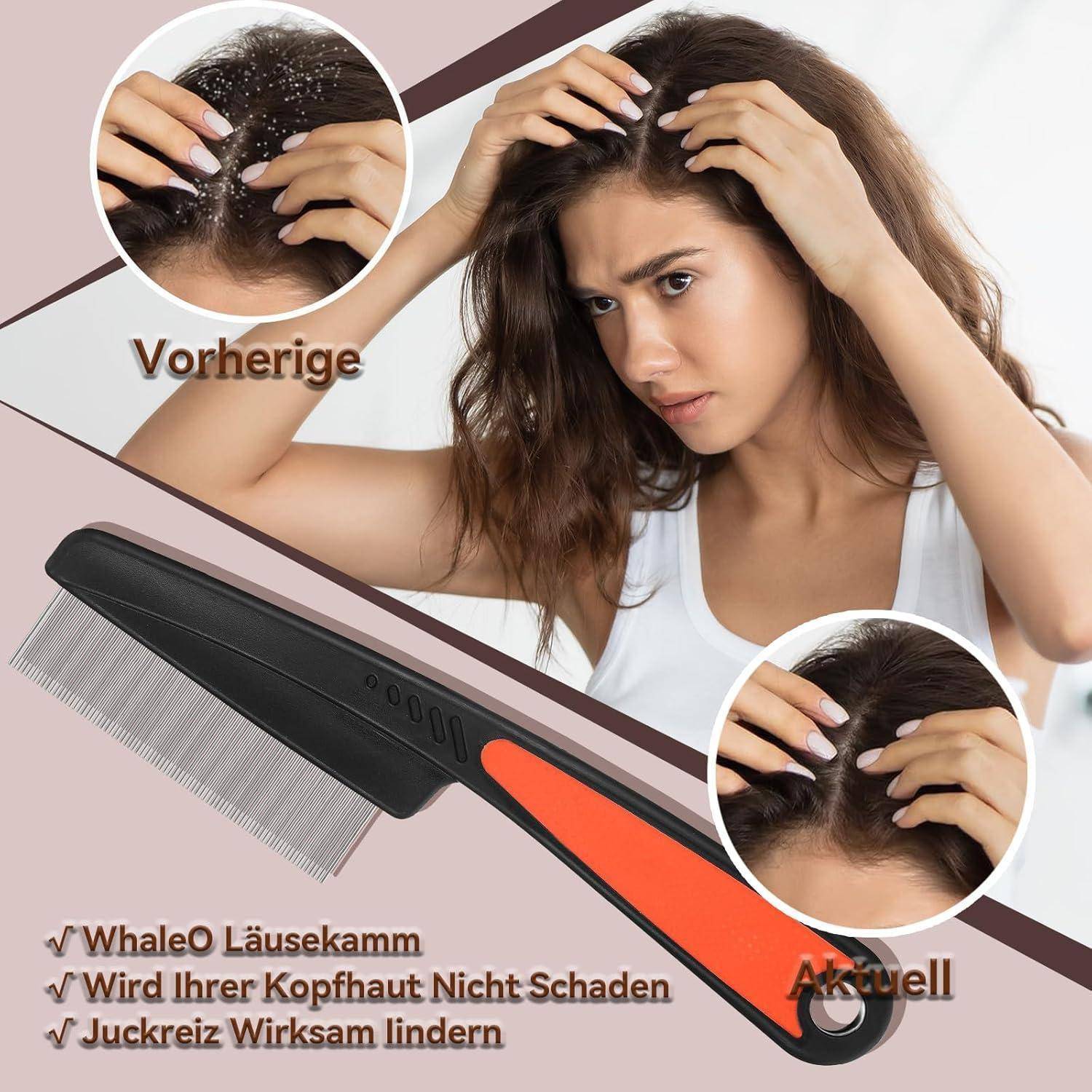 Eine Frau untersucht ihre Kopfhaut und hebt dabei Haarprobleme hervor. Eingesetzte Bilder zeigen Nahaufnahmen ihrer Kopfhaut. Ein Läusekamm ist unten abgebildet. Text liest sich: 'Vorherige', 'Aktuell'.