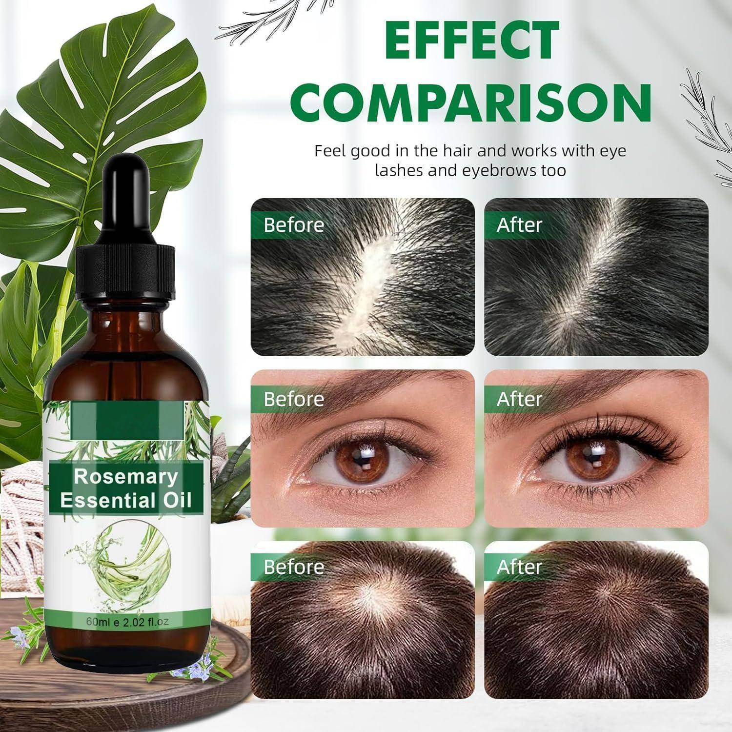 Rosmarinöl Haare 60ML Öl Hautpflege Haarwachstum Kopfhautpflege