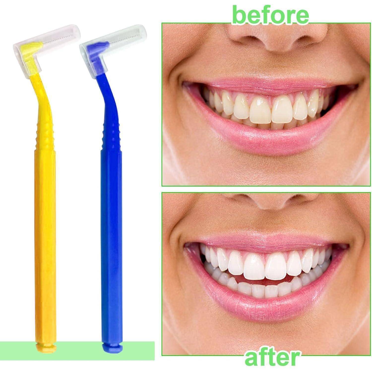 40 Stück Interdentalbürsten in 5 Farben, L-förmige