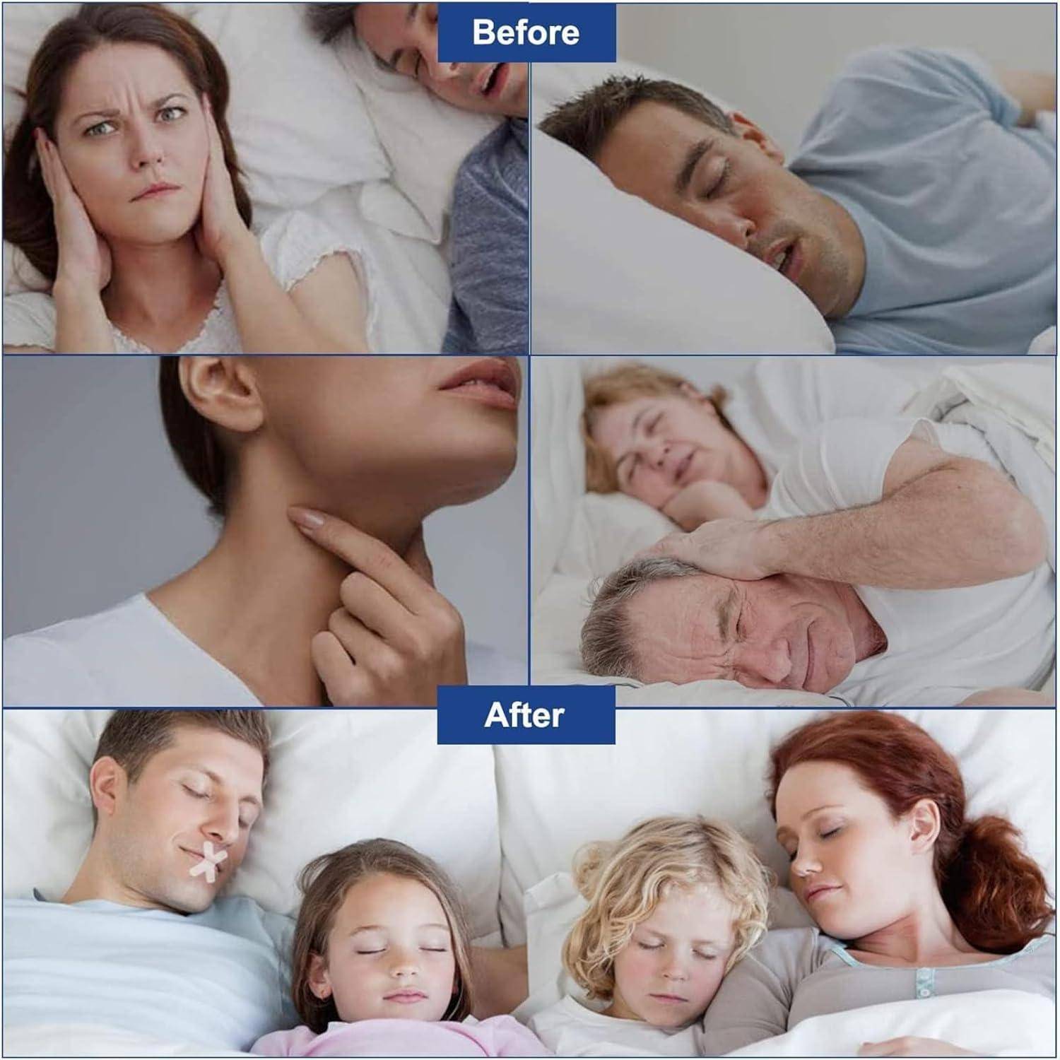 120 Stück Sleep Strips Mundband Nasenpflaster Schnarchen