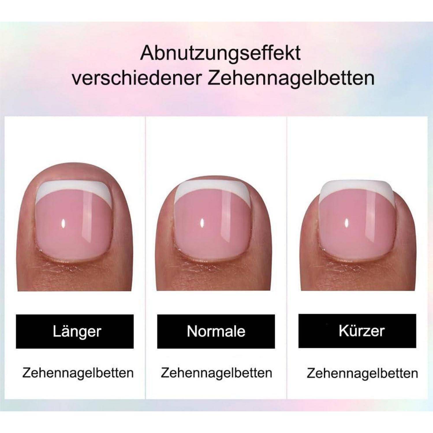 Abnutzungseffekt verschiedener Zehennagelbetten': Drei Zehennagelbetten mit den Bezeichnungen 'Länger', 'Normale' und 'Kürzer', die unterschiedliche Längen zeigen.