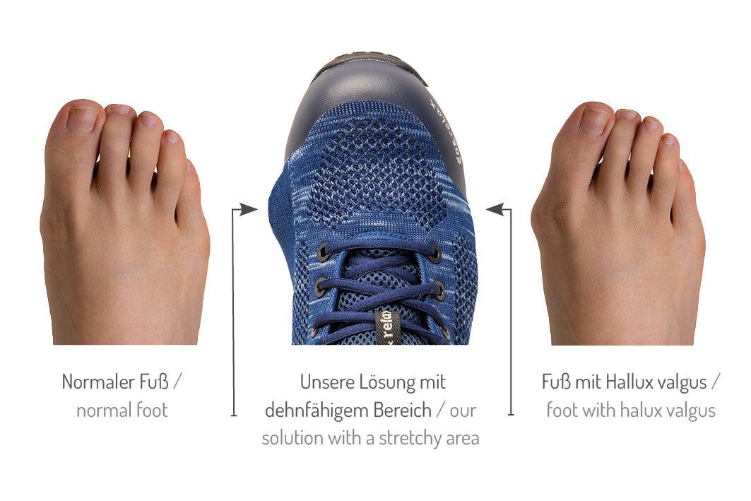 Ein Diagramm zeigt zwei Füße und einen Schuh. Der linke Fuß ist breiter, der rechte Fuß ist normal, und der Schuh hat einen dehnbaren Bereich.