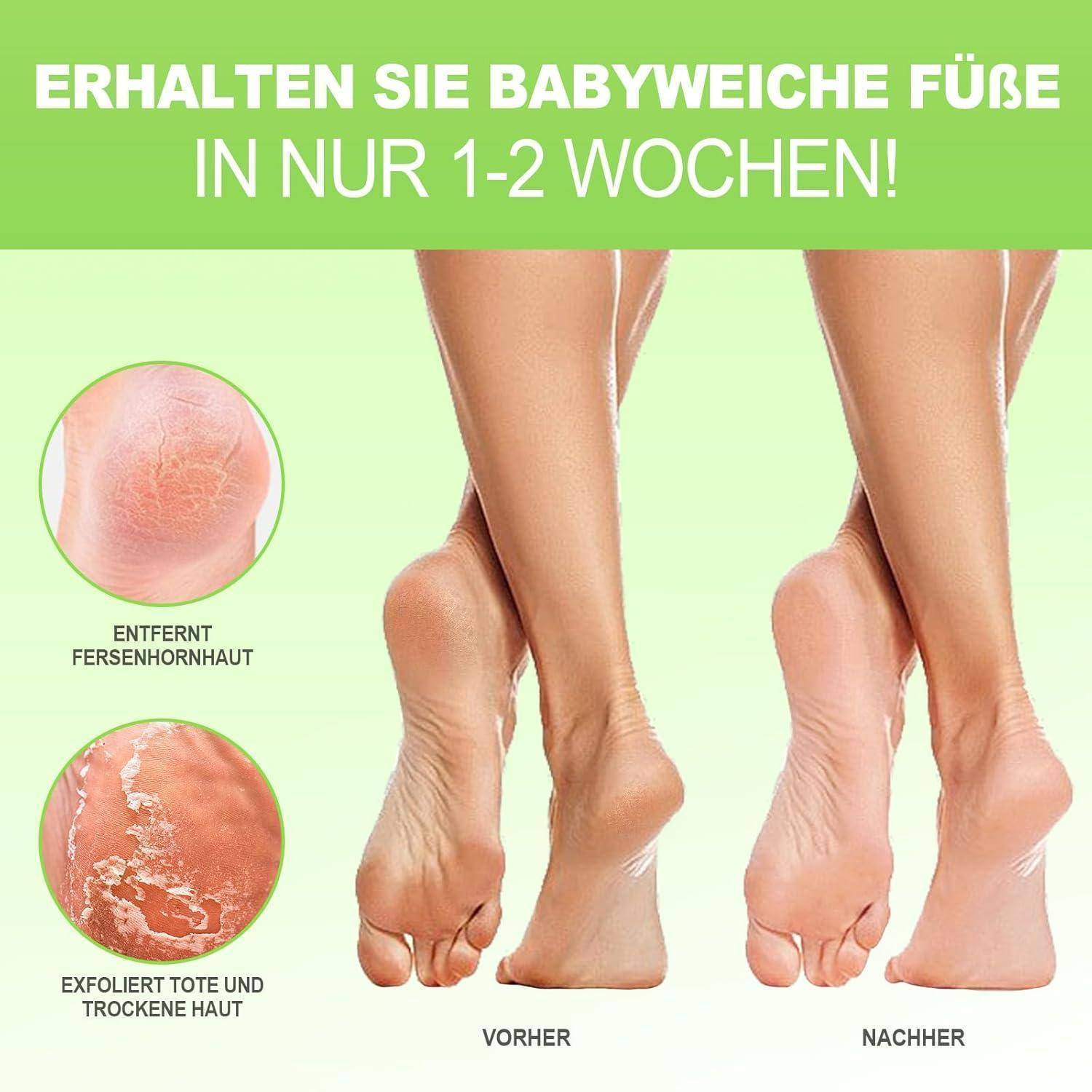Milchsäure Fußmaske 3 Paar Hornhautentferner Hornhaut Socken fußpflege
