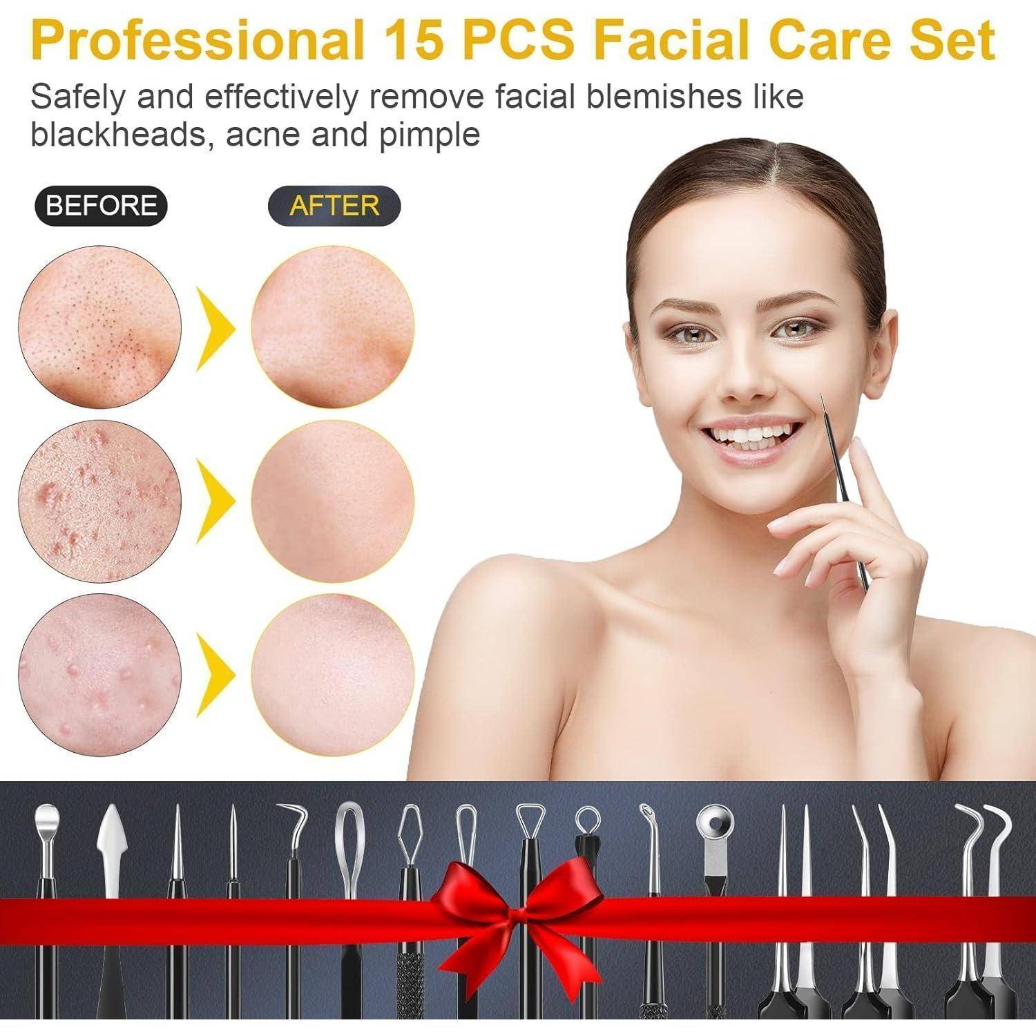 Mitesserentferner Set 15 Stücke Komedonenquetscher Blackhead Remover